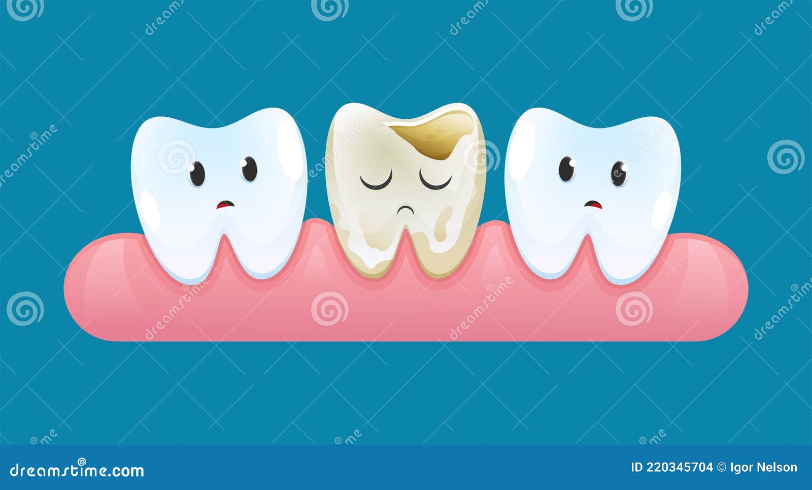 Dos Dientes Tristes En Encía Miran Un Diente Con Caries. Vector Estilo De  Dibujos Animados Ilustración del Vector - Ilustración de decaimiento,  salud: 220345704