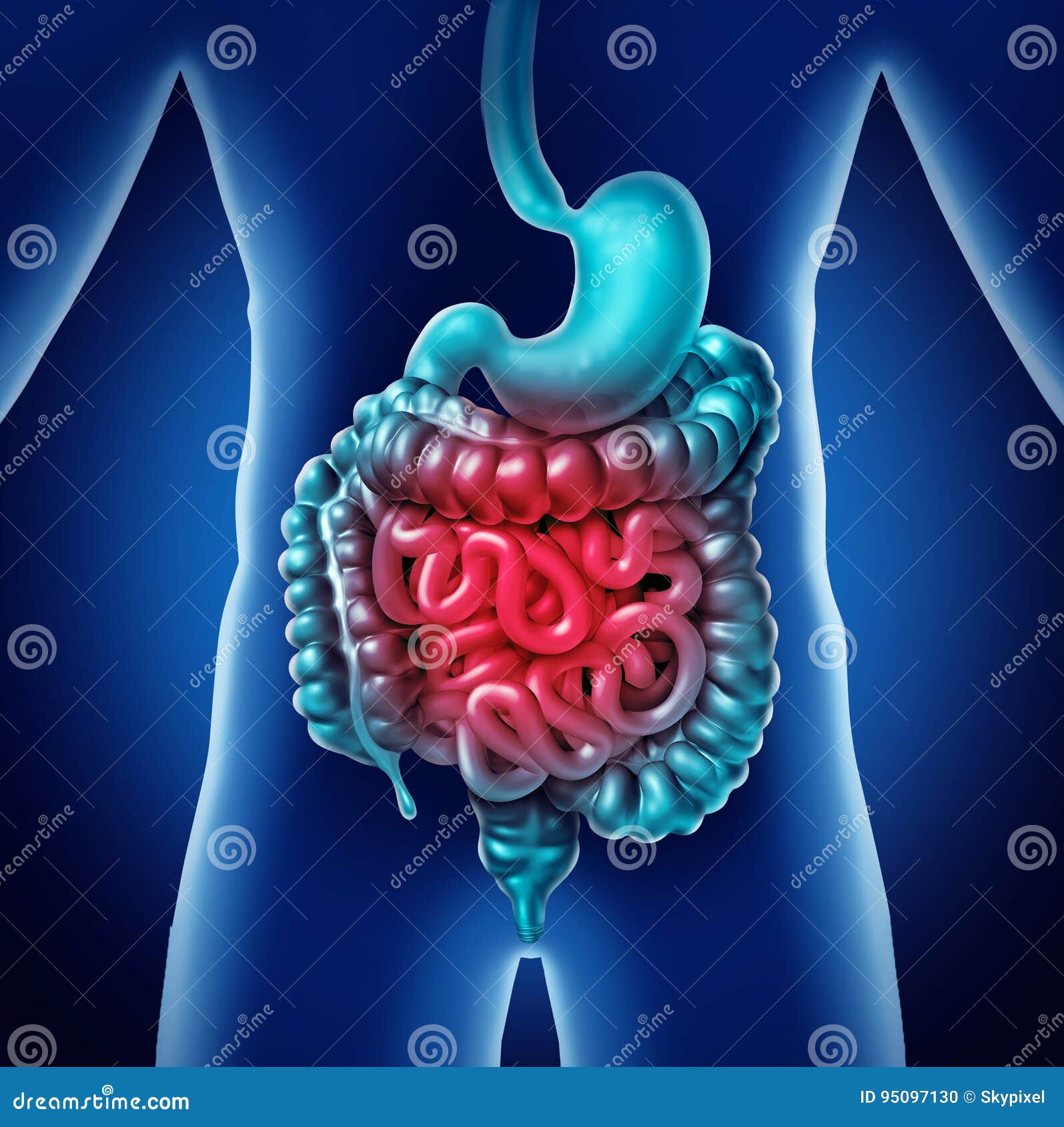 Douleur d'intestin illustration stock. Illustration du abdomen 95097130