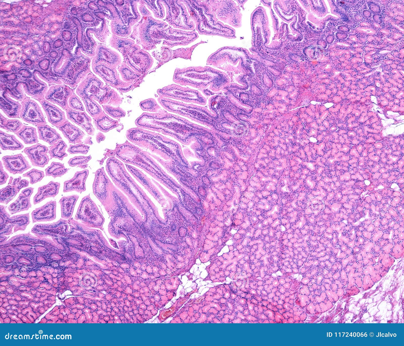 Duodeno Glándulas De Brunnerâ€™s Foto de archivo Imagen de zona