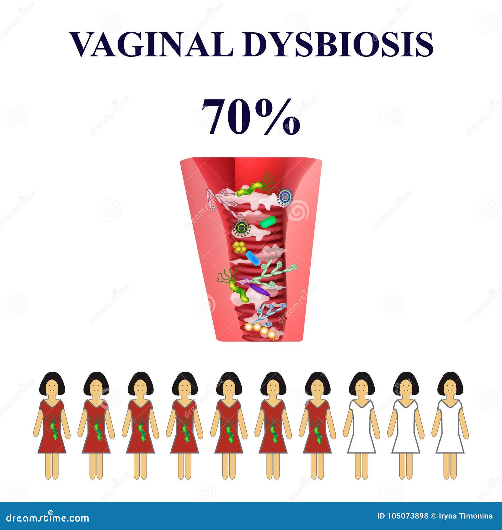 dysbacteriosis of the vagina. vaginitis. candidiasis. 70 percent of women are ill.