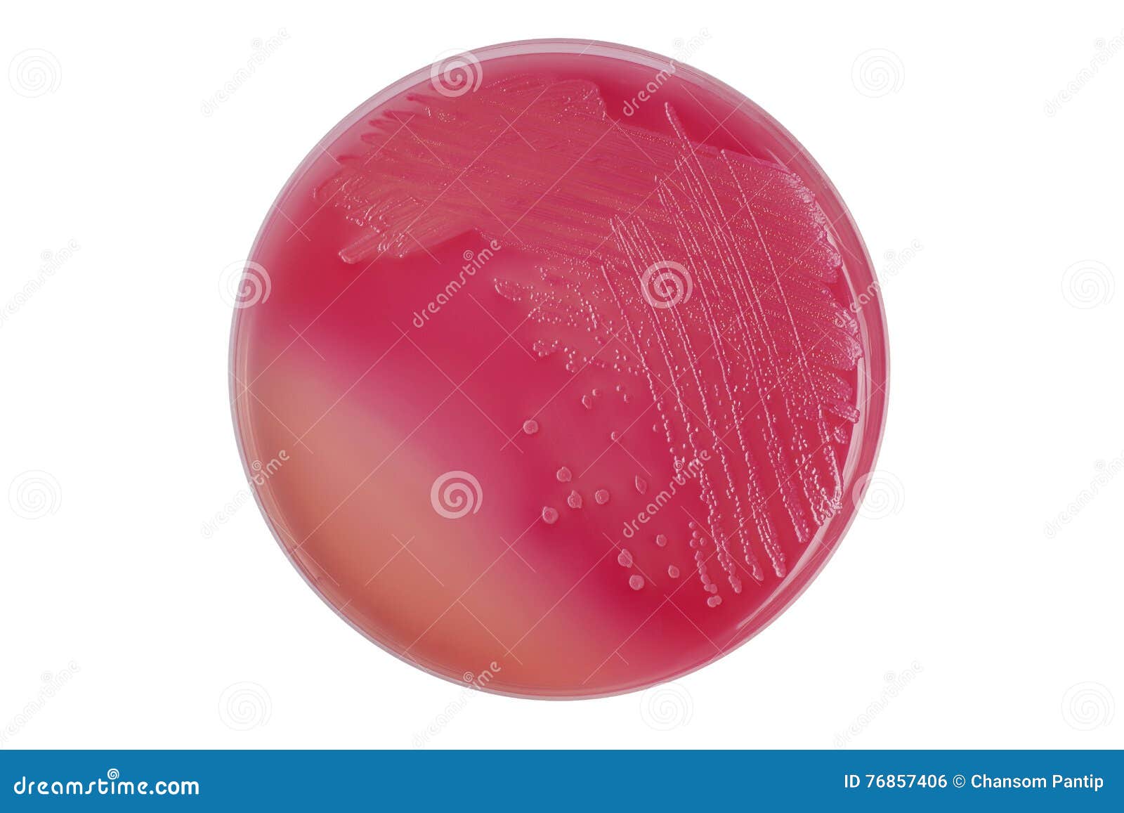 e. coli (escherichia coli) bacterial colonies on macconkey agar p