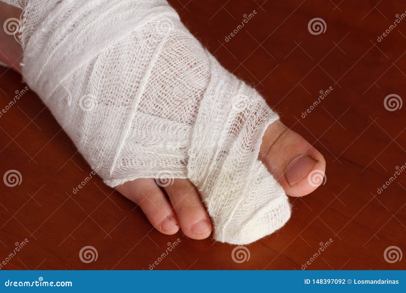 Toe bandage foto de stock. Imagem de porta, macho, dedo 148397092