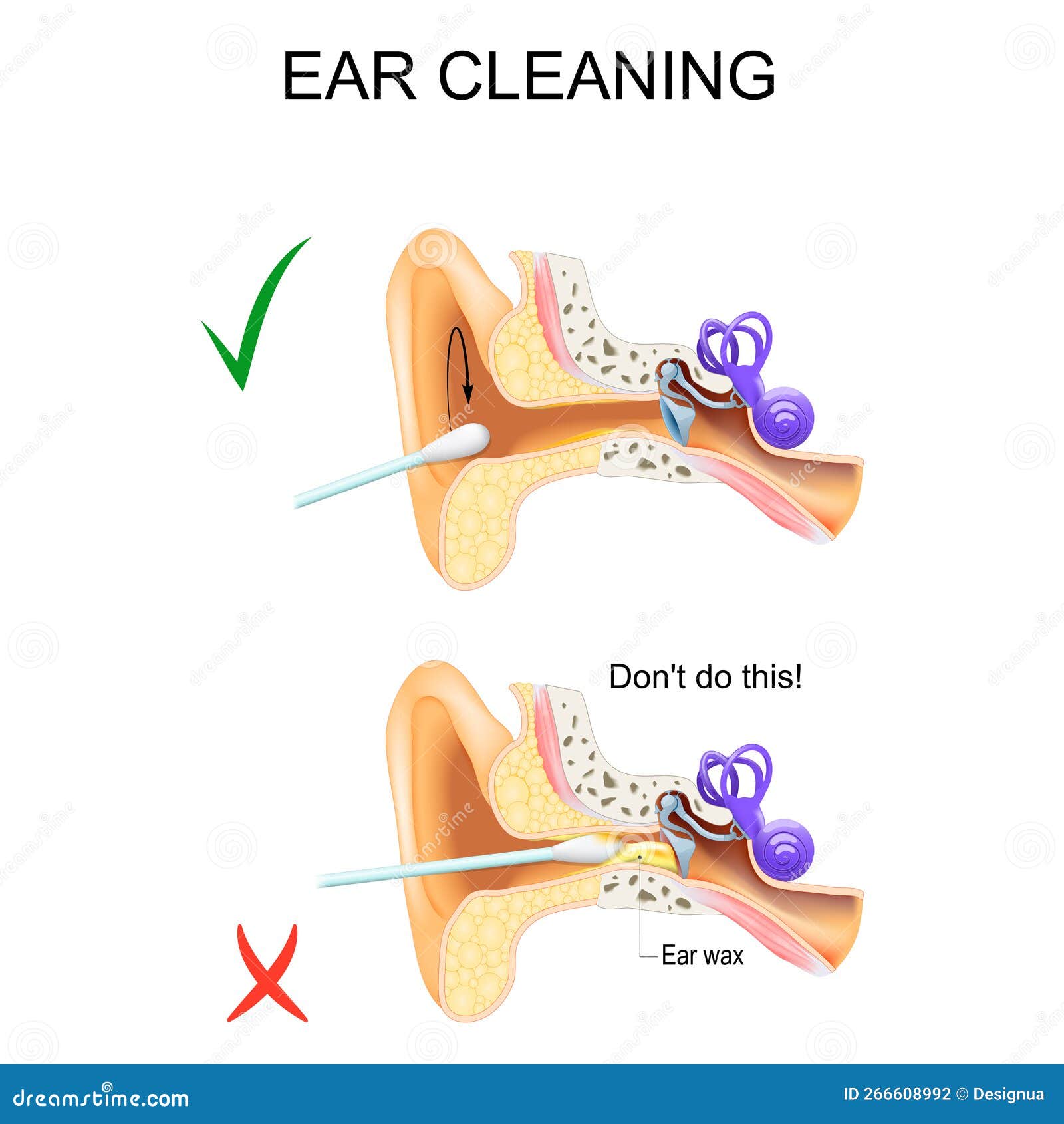 earwax removal Derby