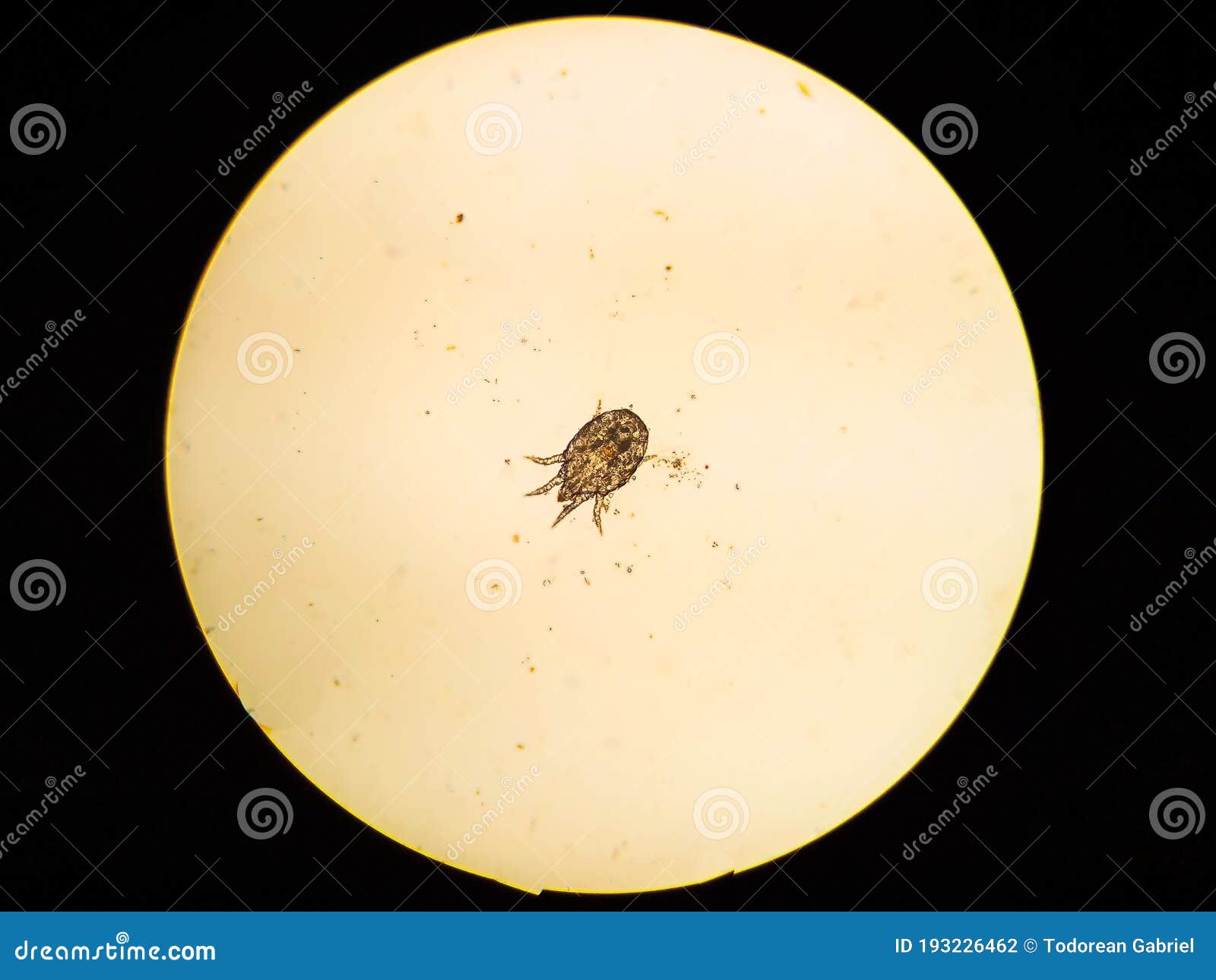 Ear Mite from a Cat, Under the Microscope Stock Photo Image of stage