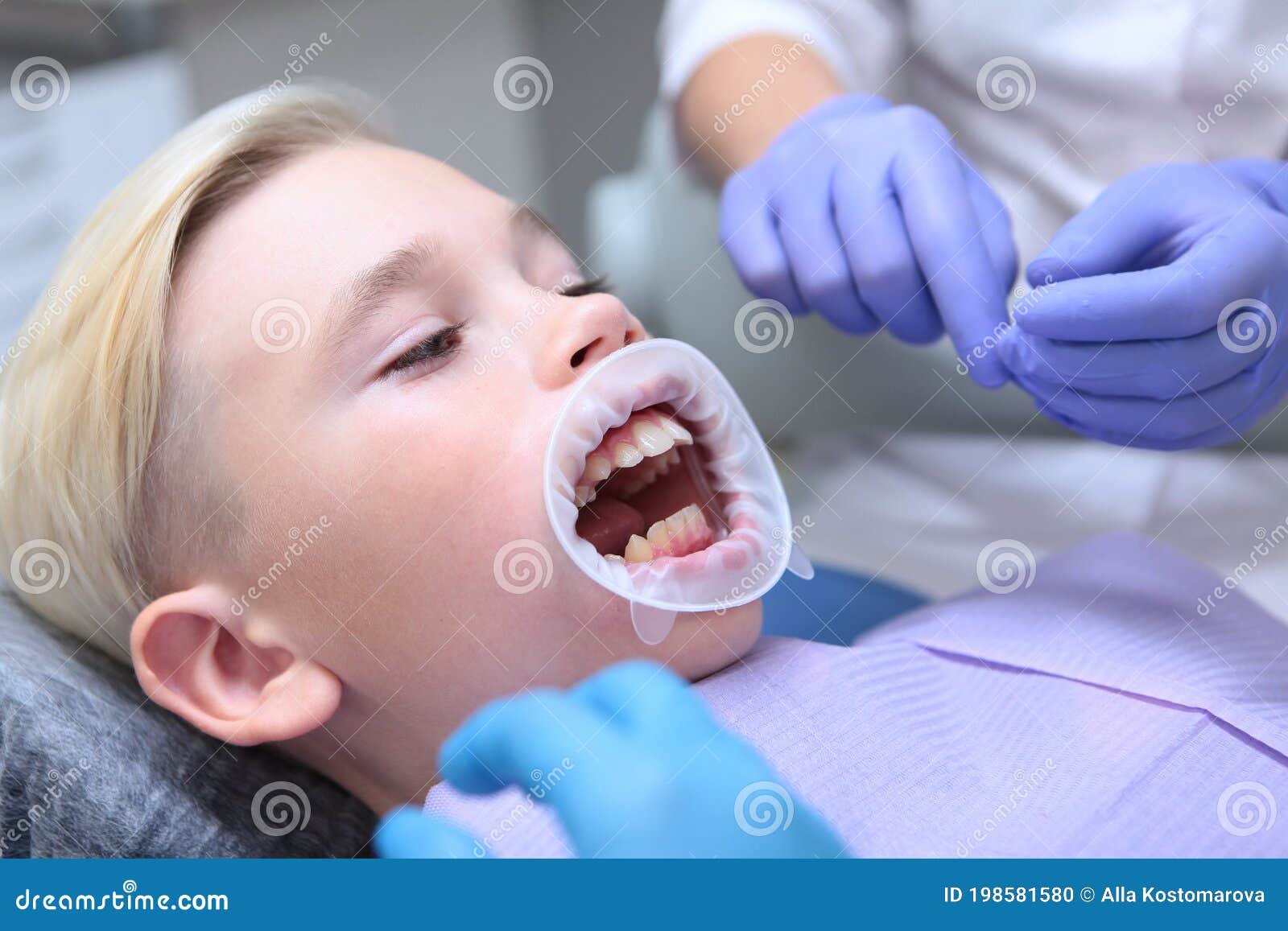 Ecarteur Dentaire Dans Une Bouche De Petit Garçon Confort Pour Les
