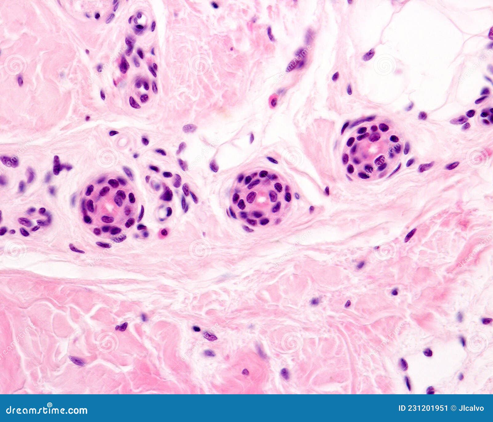 Eccrine Sweat Gland Excretory Duct Stock Image Image Of Microscope