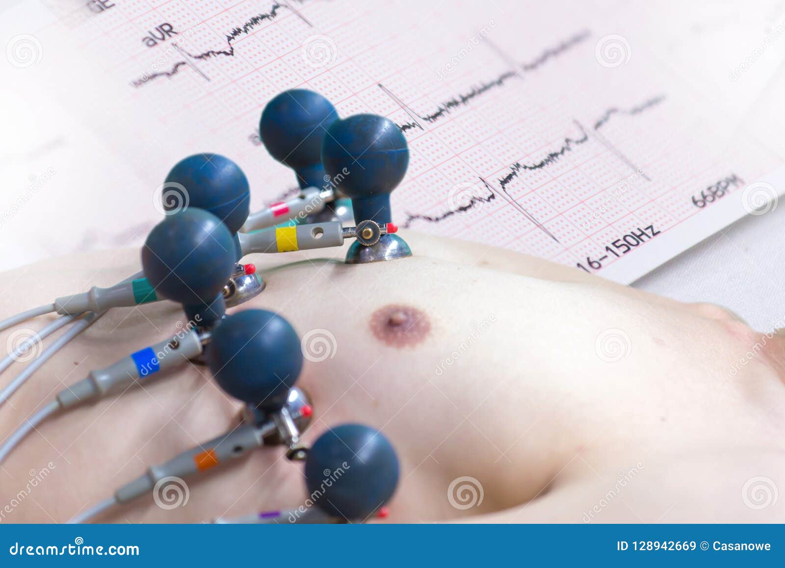 ecg or ekg legs of man with electrodes for electrocardiogram rec