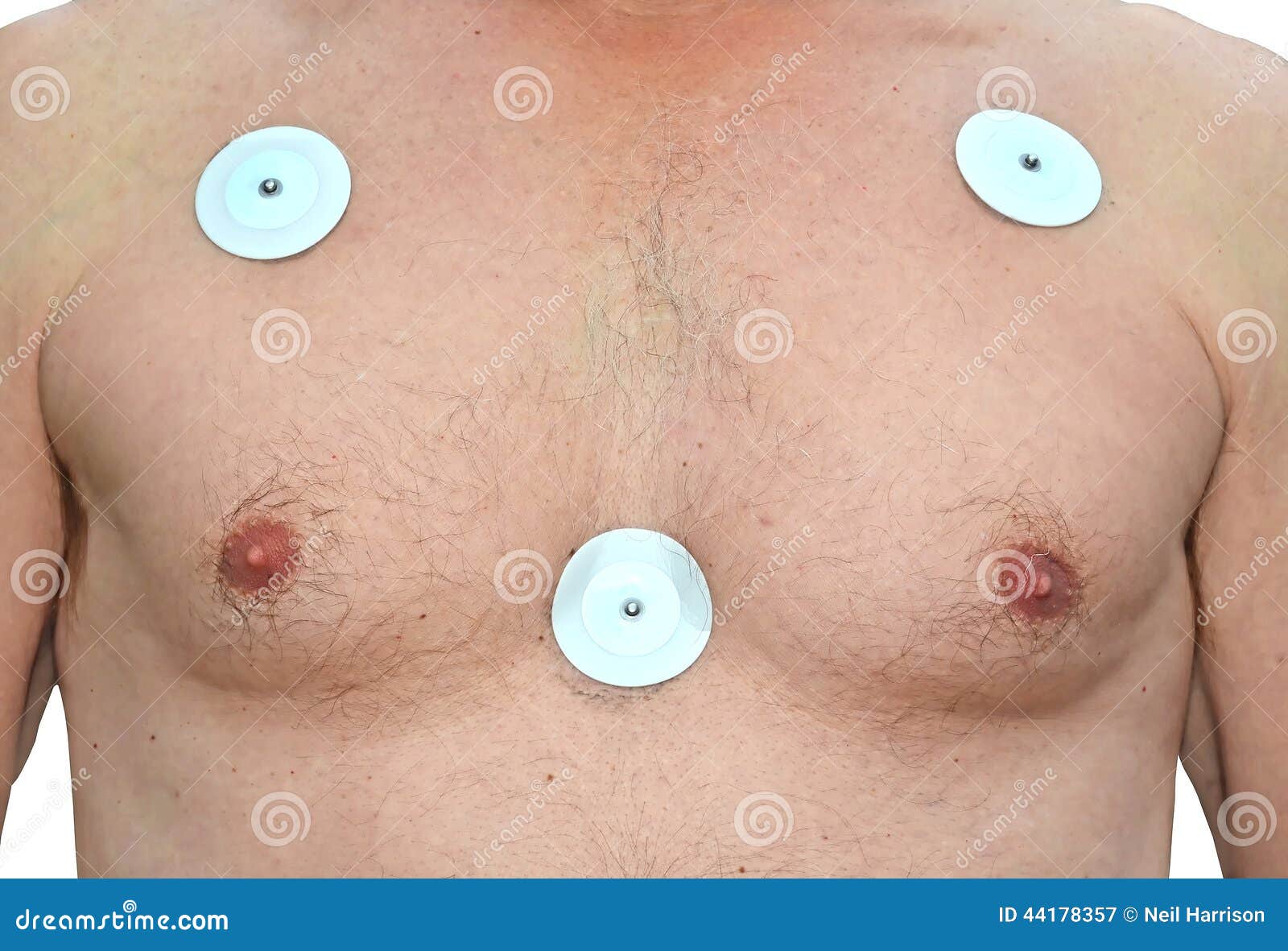 Ecg exame