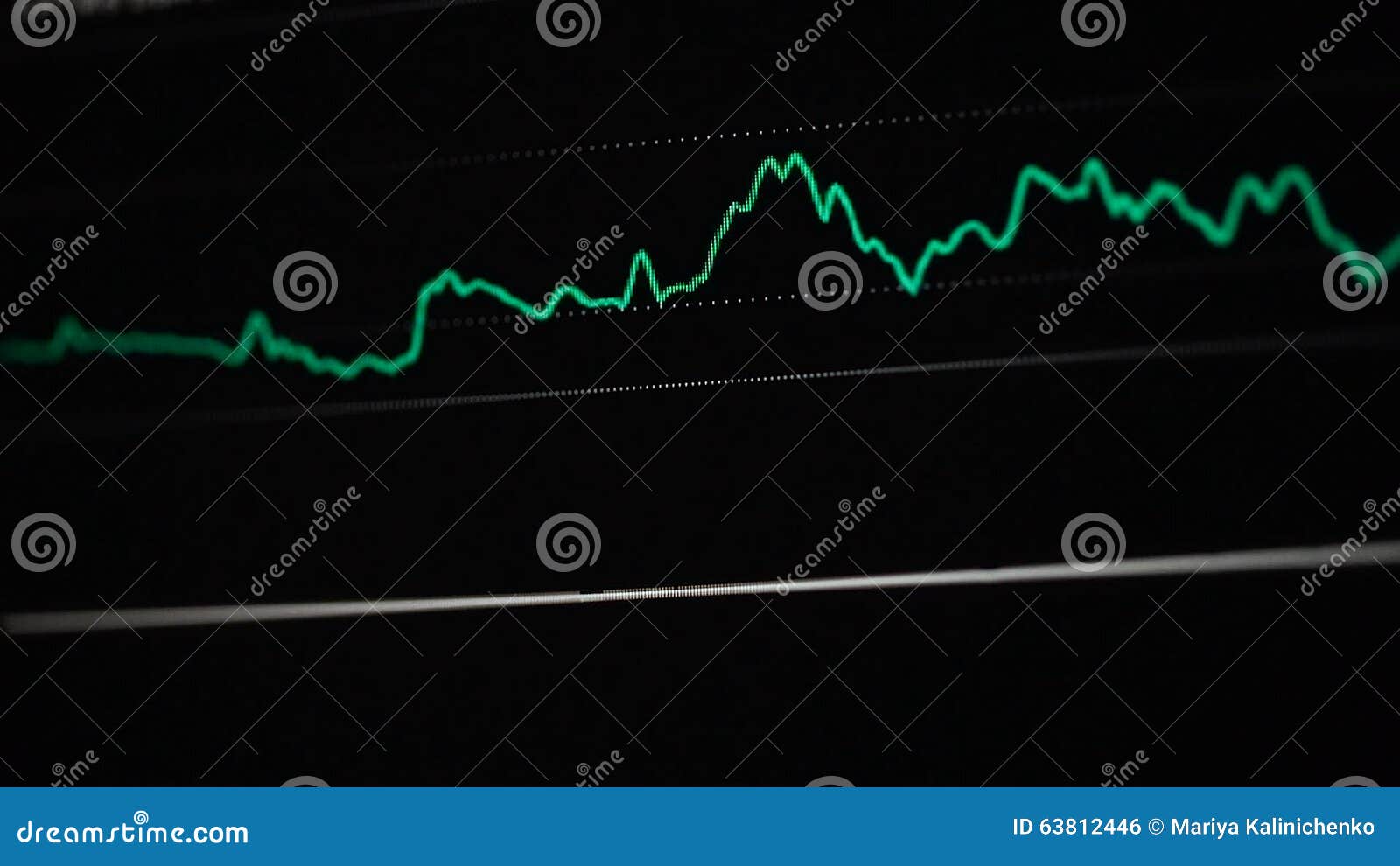 Ecg Heartbeat Black Background Stock Footage & Videos - 313 Stock Videos