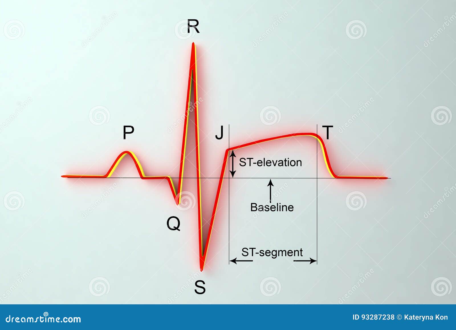Ecg Chart Labeled