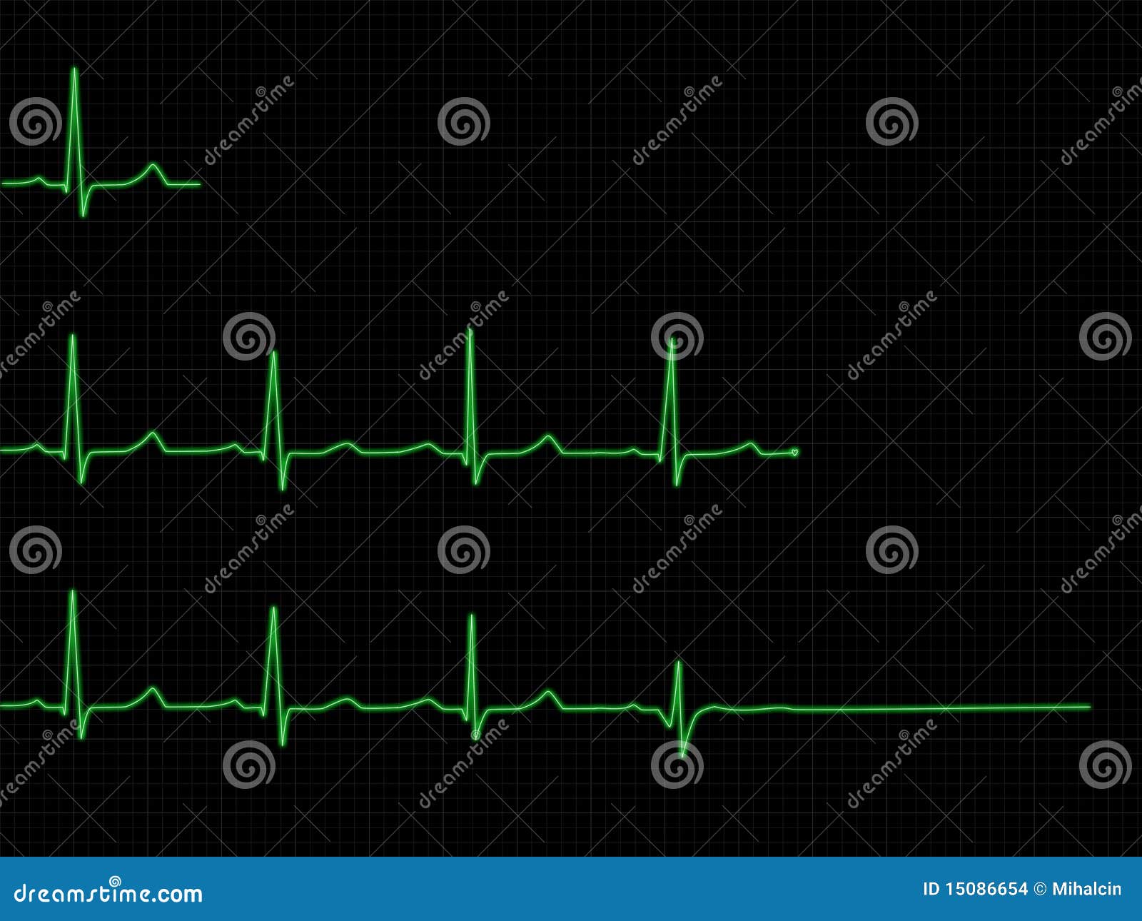 ecg set