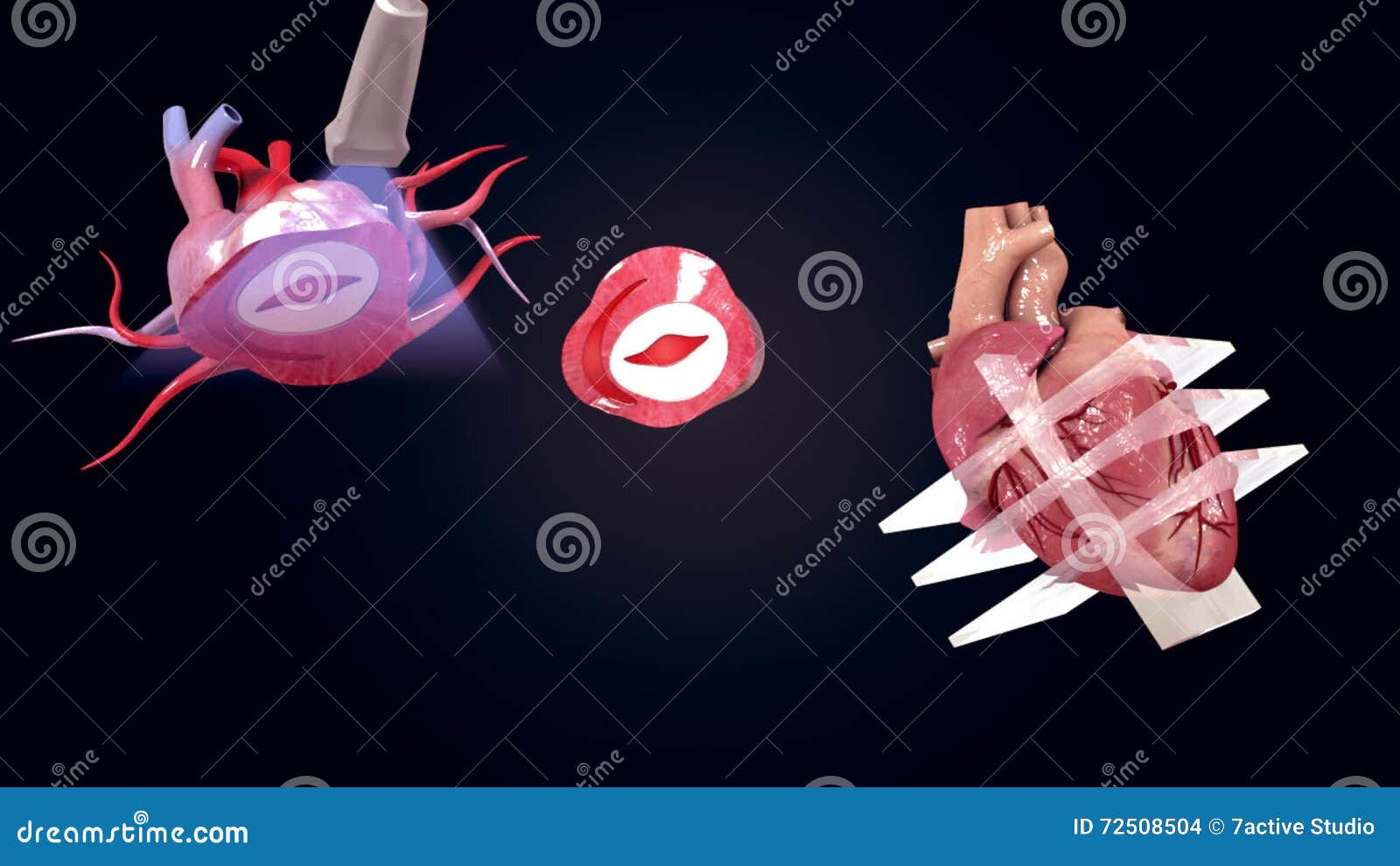 Echocardiogram Cartoons, Illustrations & Vector Stock Images - 799