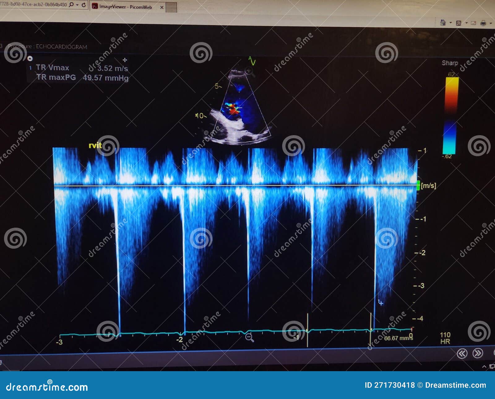 echocardiogram colorful probe targeting map and waveforms