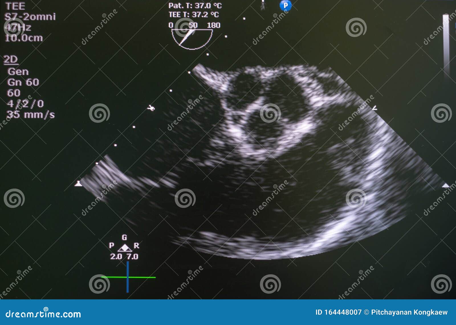 Echocardiography Ultrasound Machine. Stock Image | CartoonDealer.com
