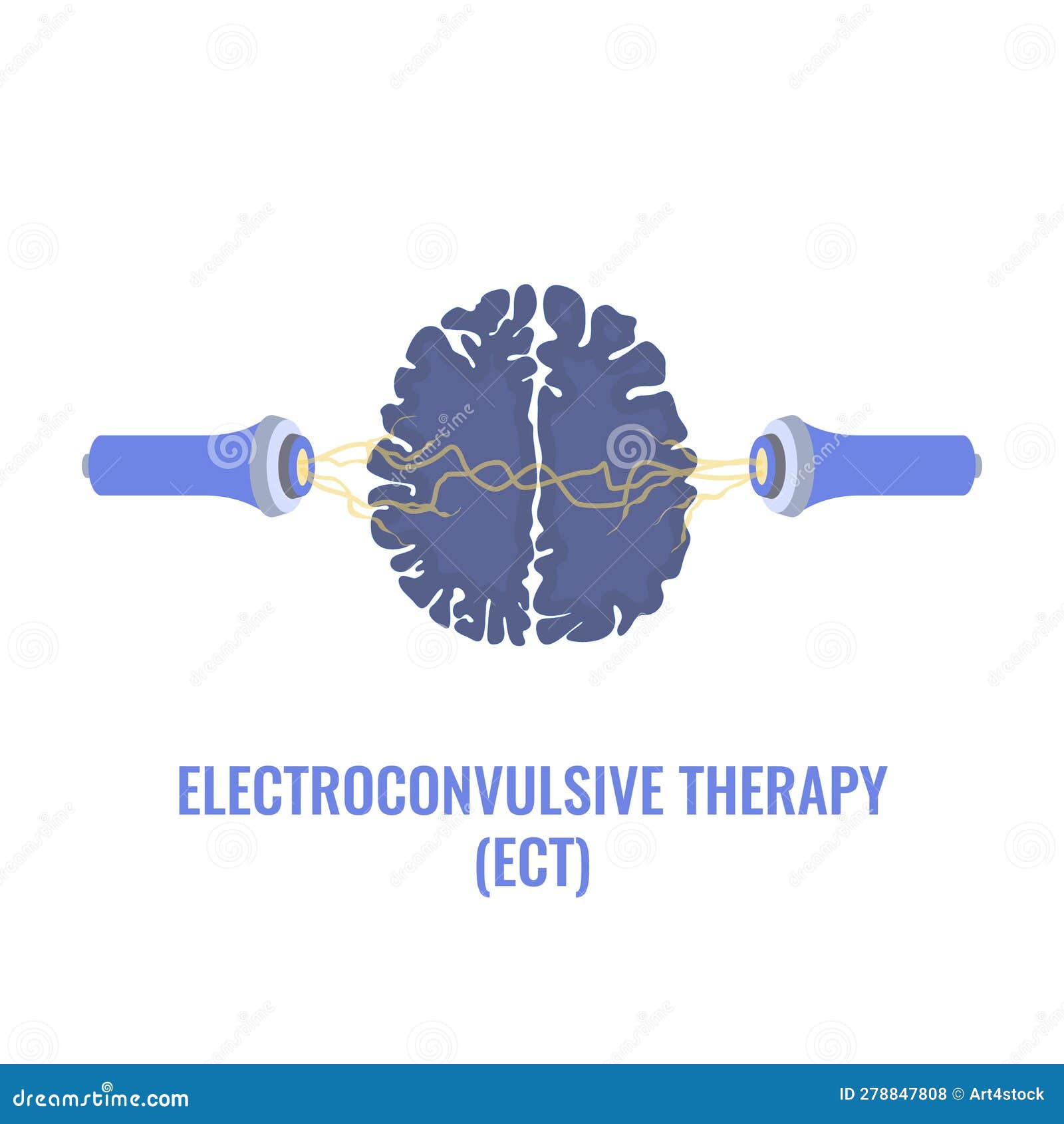 ECT Electroconvulsive Therapy for Severe Depression Treatment Stock