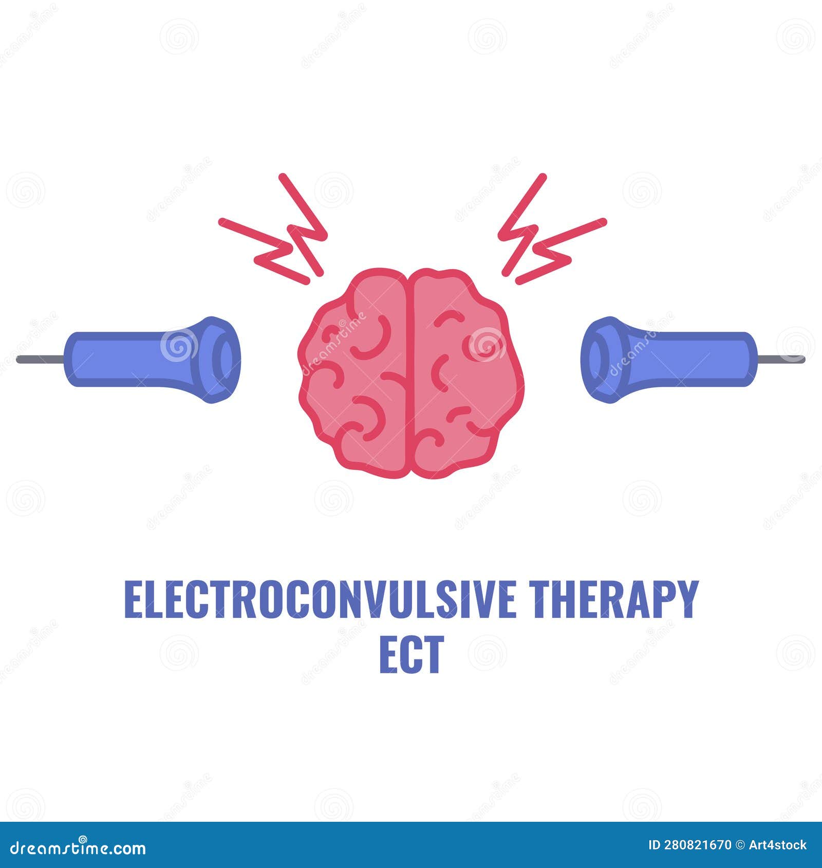 ECT Electroconvulsive Therapy for Severe Depression Treatment Stock