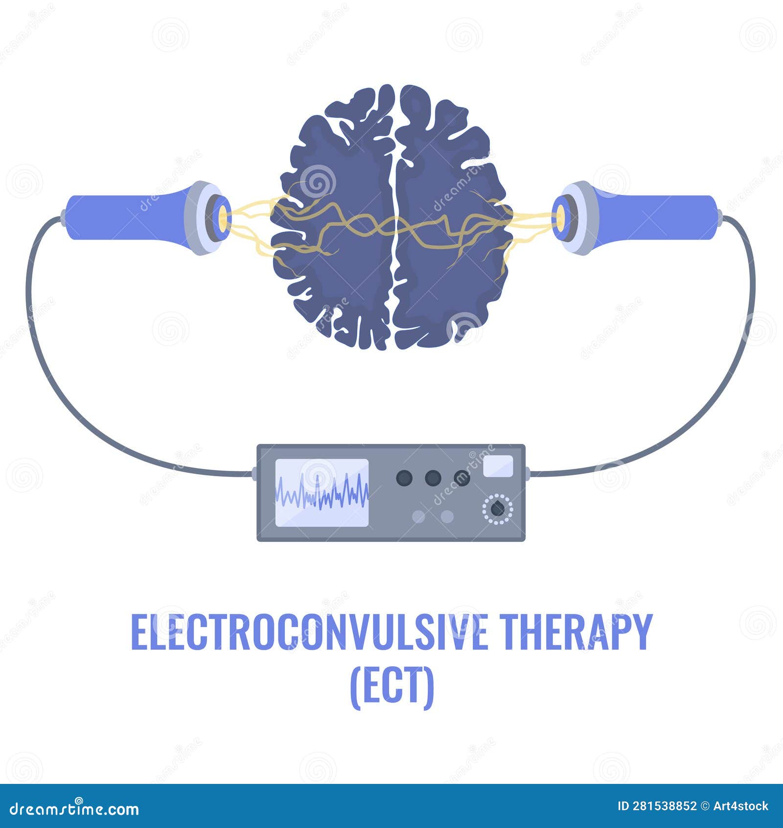 ECT Electroconvulsive Therapy for Severe Depression Treatment Stock