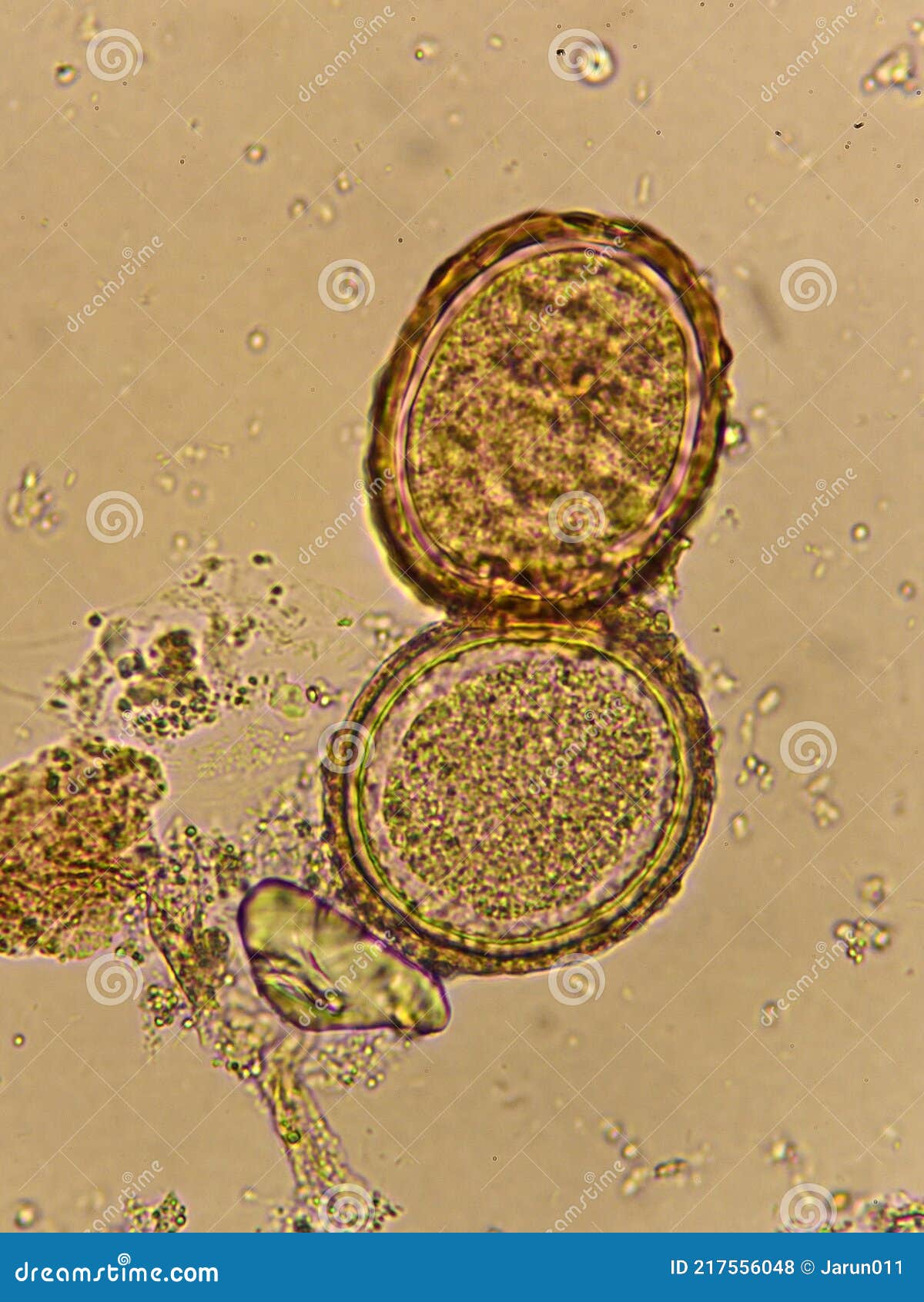 roundworm eggs in humans