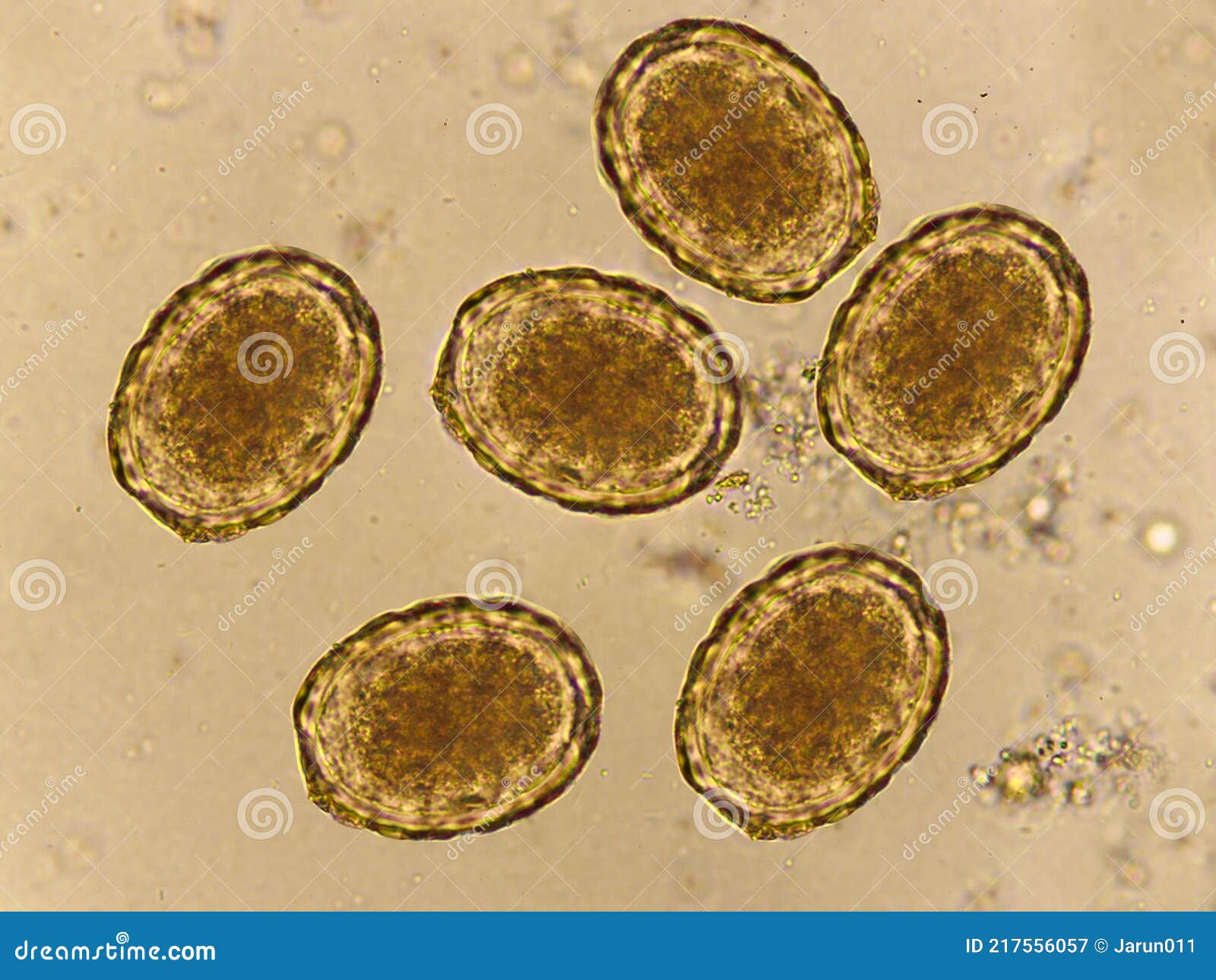 roundworm eggs in humans