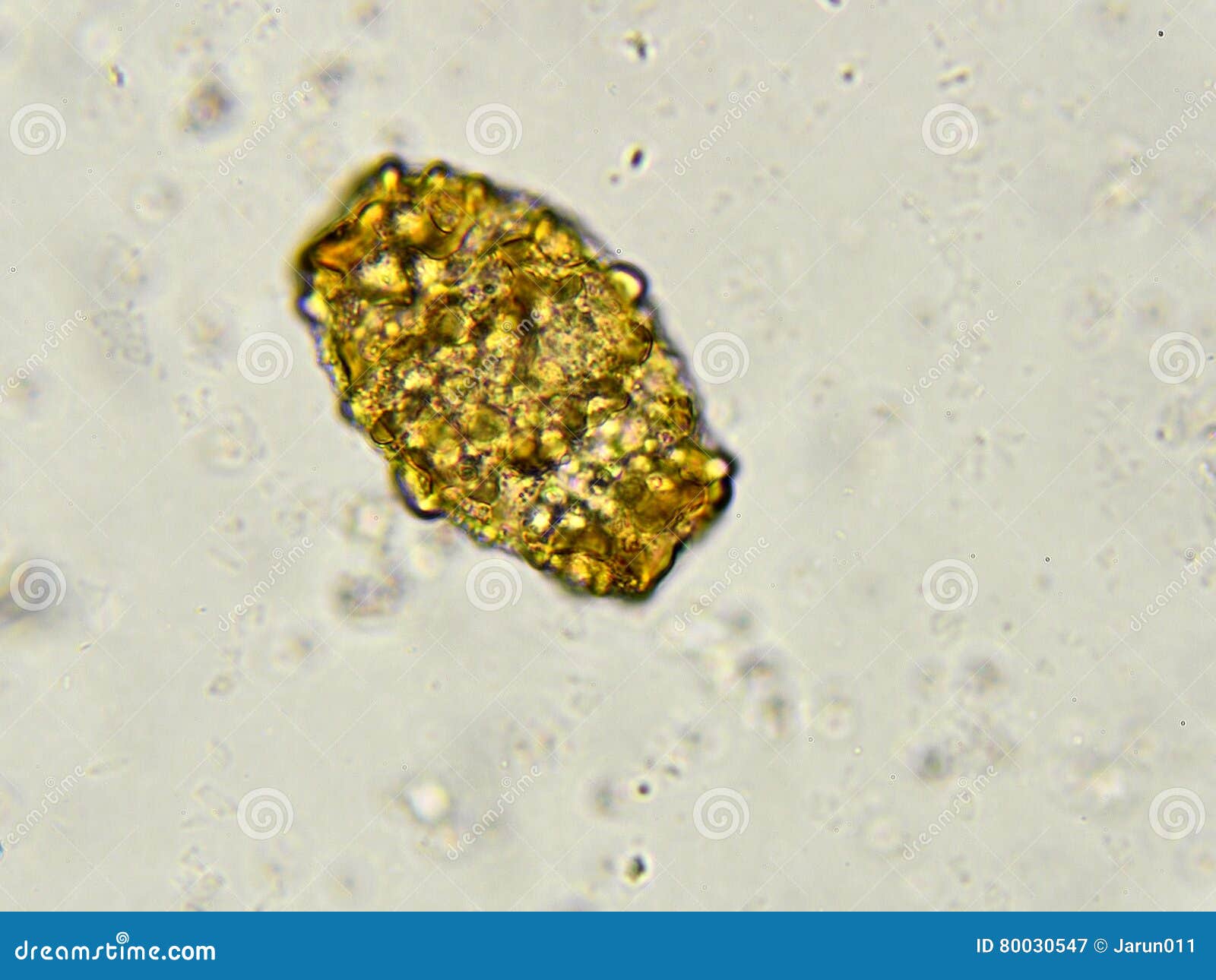 Споры в кале у взрослого. Ascaris lumbricoides яйца микроскоп. Яйца аскарид микроскопия. Яйца Ascaris lumbricoides в Кале.