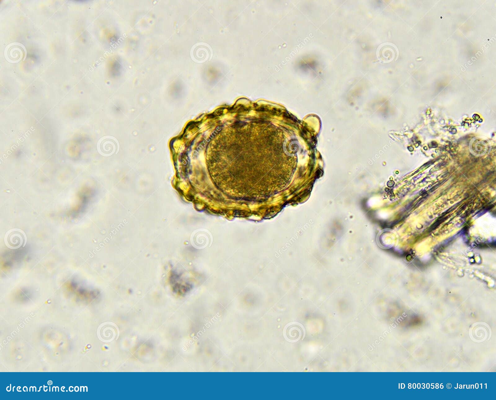 roundworm in stool