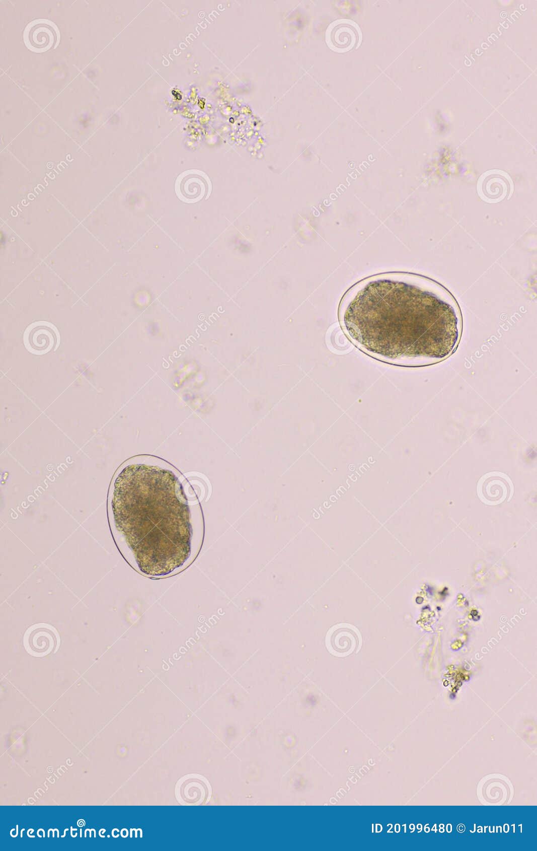 Hookworm Egg Human Parasite In Stool Examination Test Stock Photo