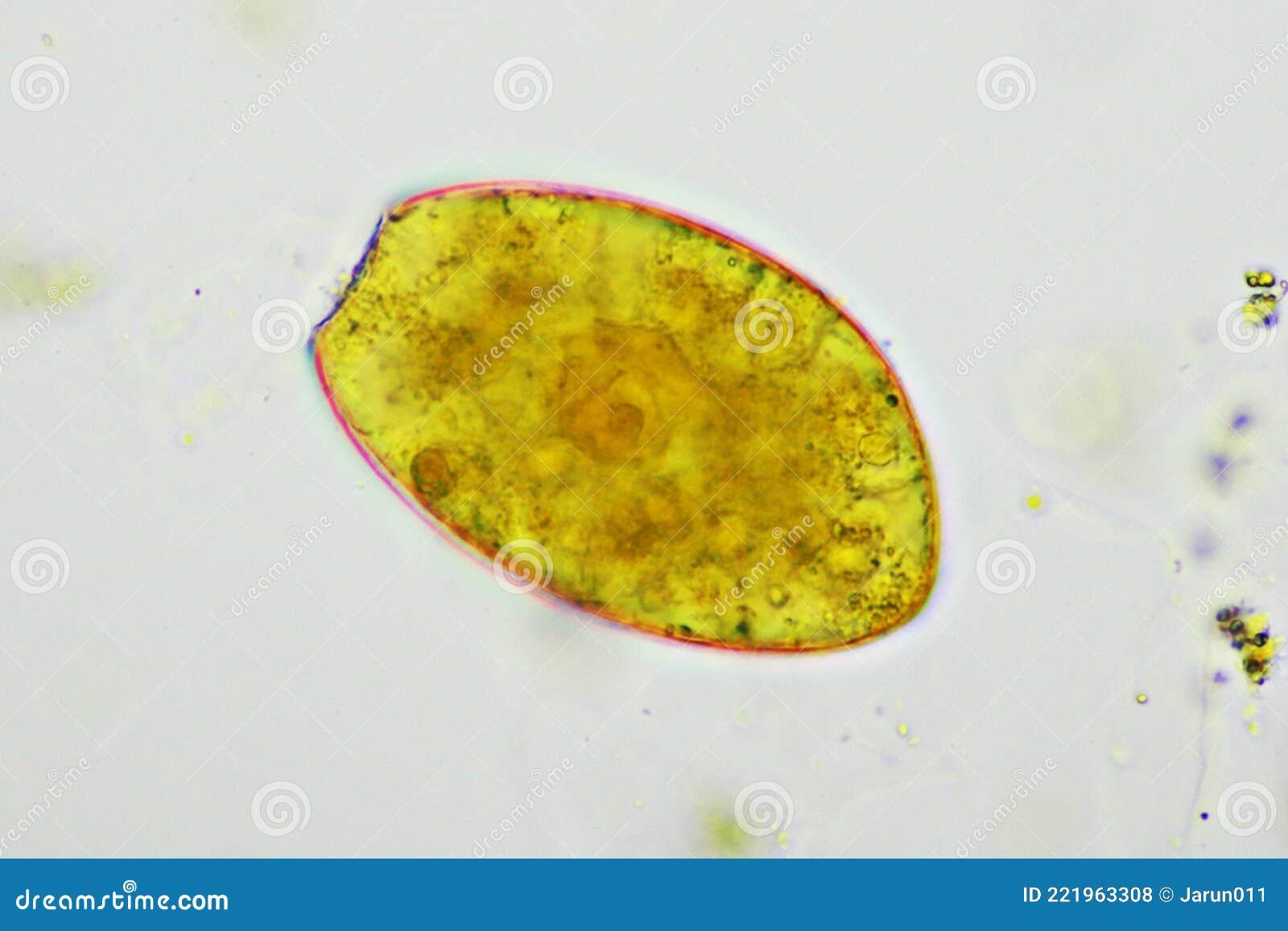 Egg of Intestinal Fluke in Human Stool Stock Photo - Image of liver, 400x:  221963308