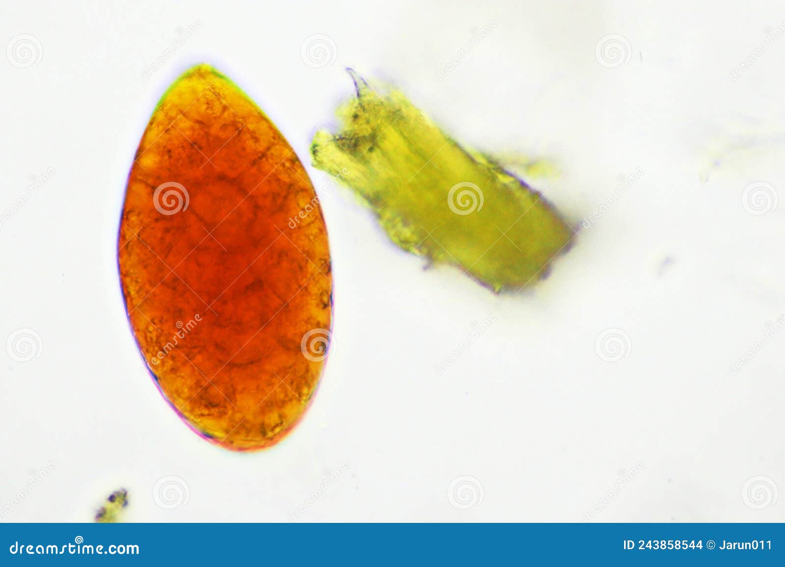 Egg of Intestinal Fluke in Human Stool Stock Photo - Image of ascariasis,  microscopy: 243858544