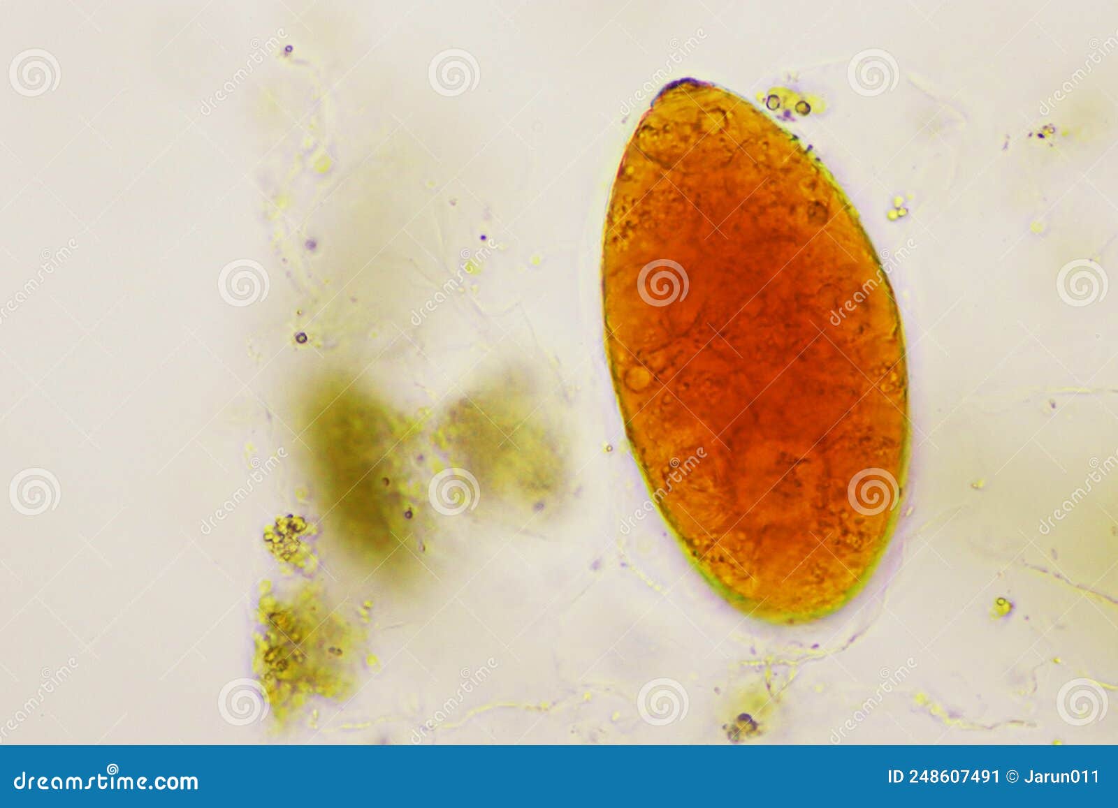 Egg of Intestinal Fluke in Human Stool Stock Image - Image of