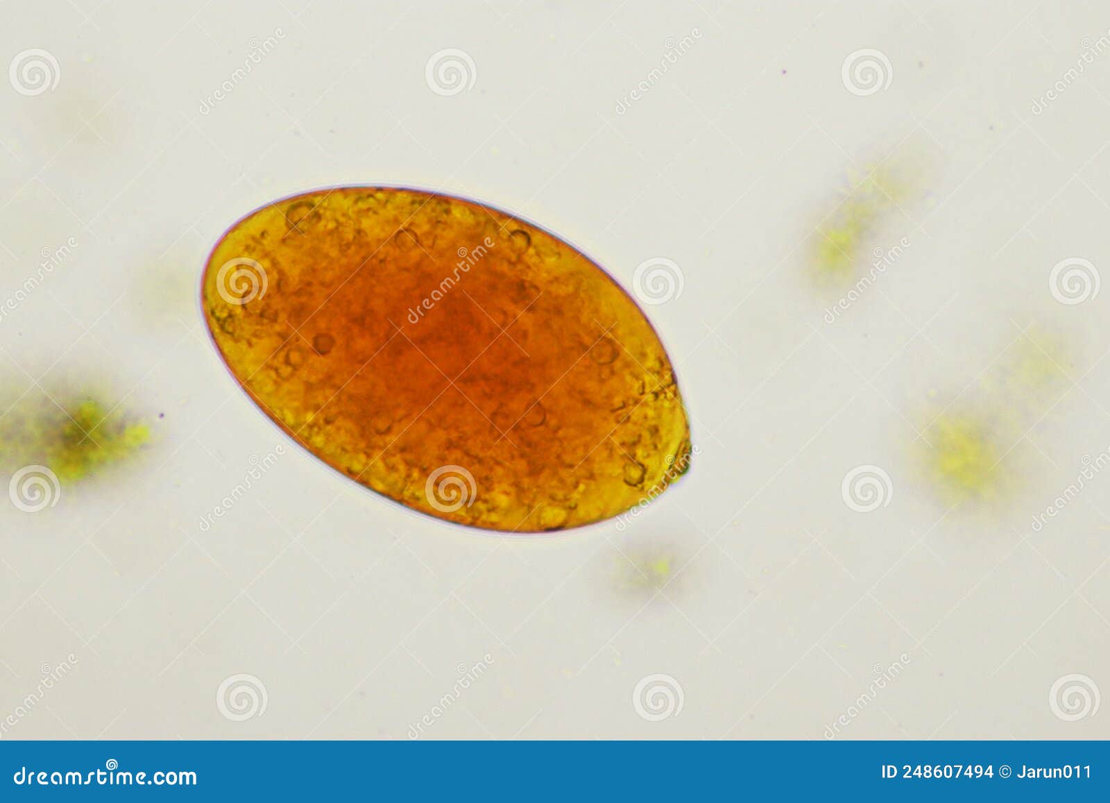 egg of intestinal fluke in human stool