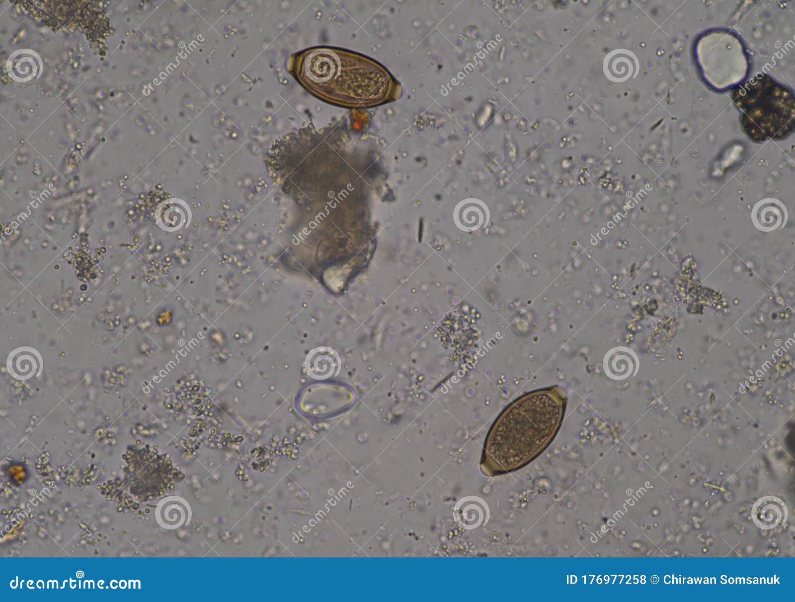Egg of Parasite in Stool Examition Testing Stock Photo Image of flat