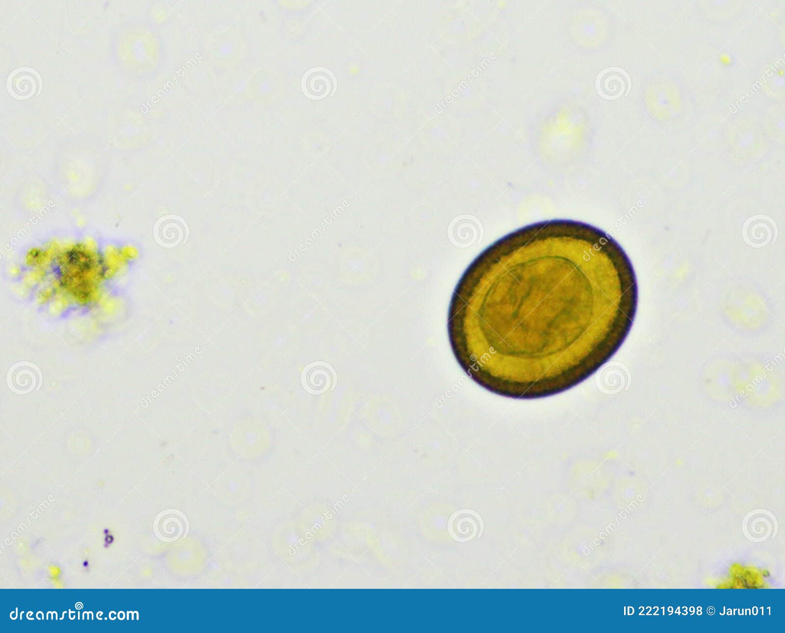 egg of taenia or tapeworm in human stool