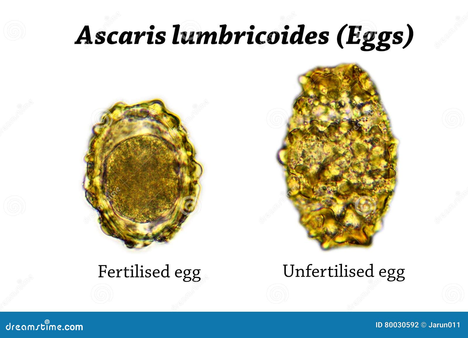 Ascaris Lumbricoides Fertilized Egg