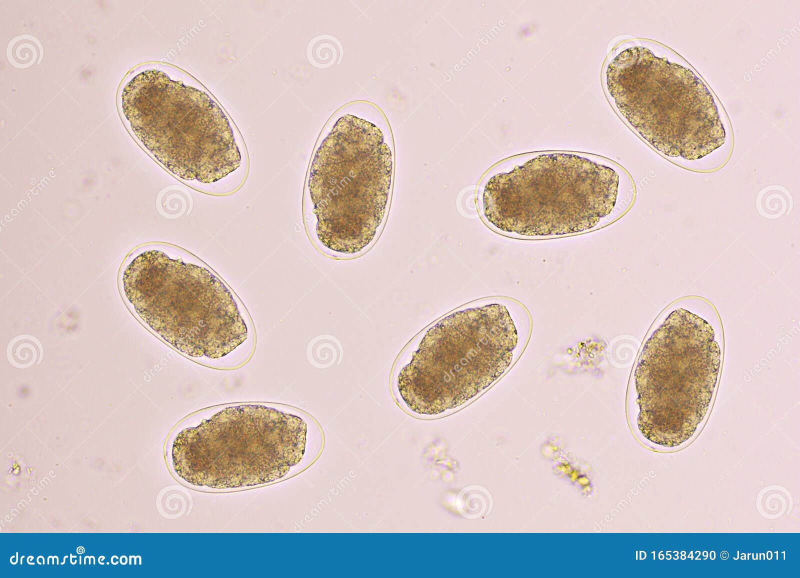 https://thumbs.dreamstime.com/z/eggs-hookworm-human-stool-analyze-microscope-original-magnification-x-165384290.jpg