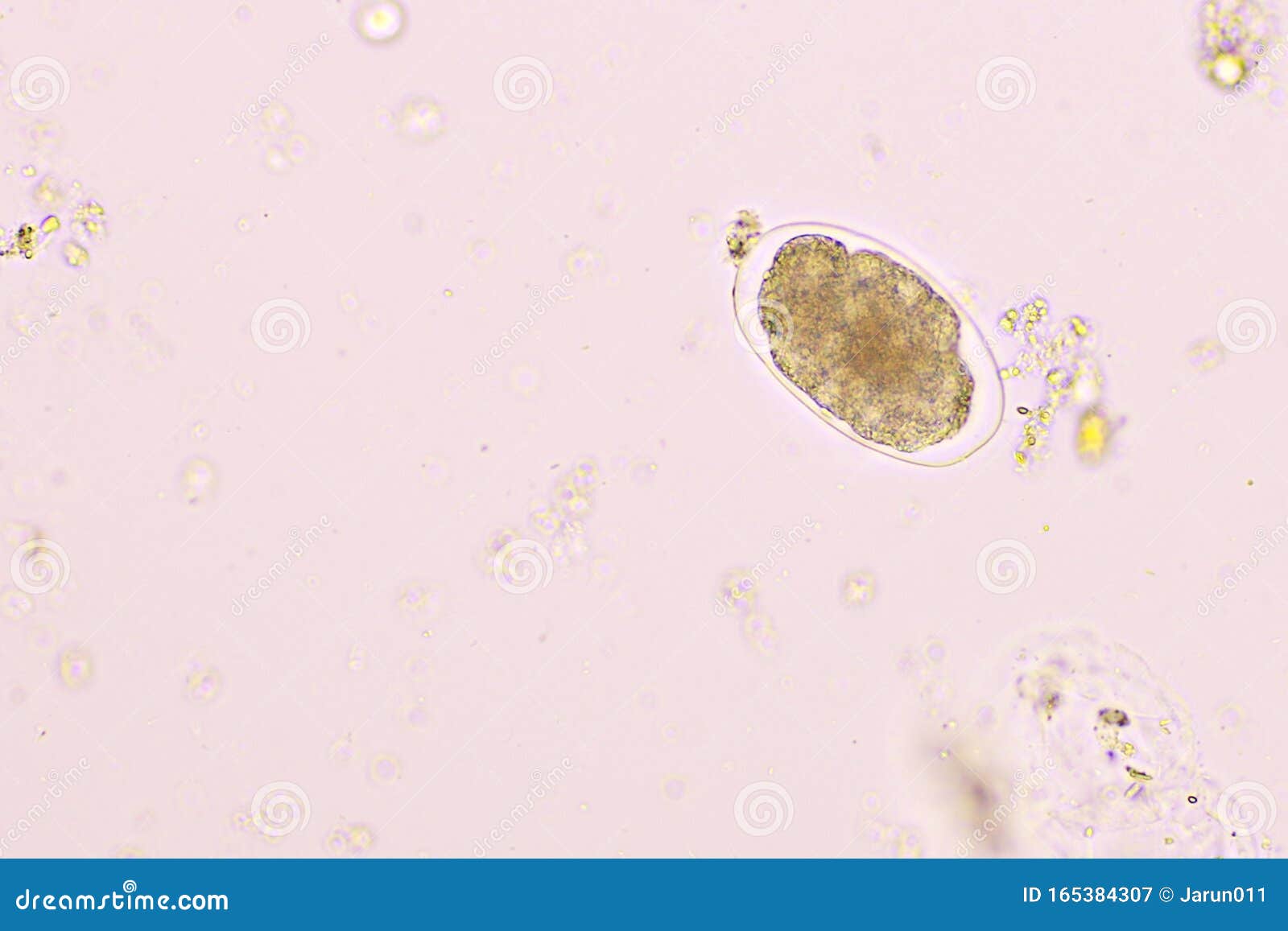 Eggs of Hookworm in Human Stool Stock Image Image of human, fluke