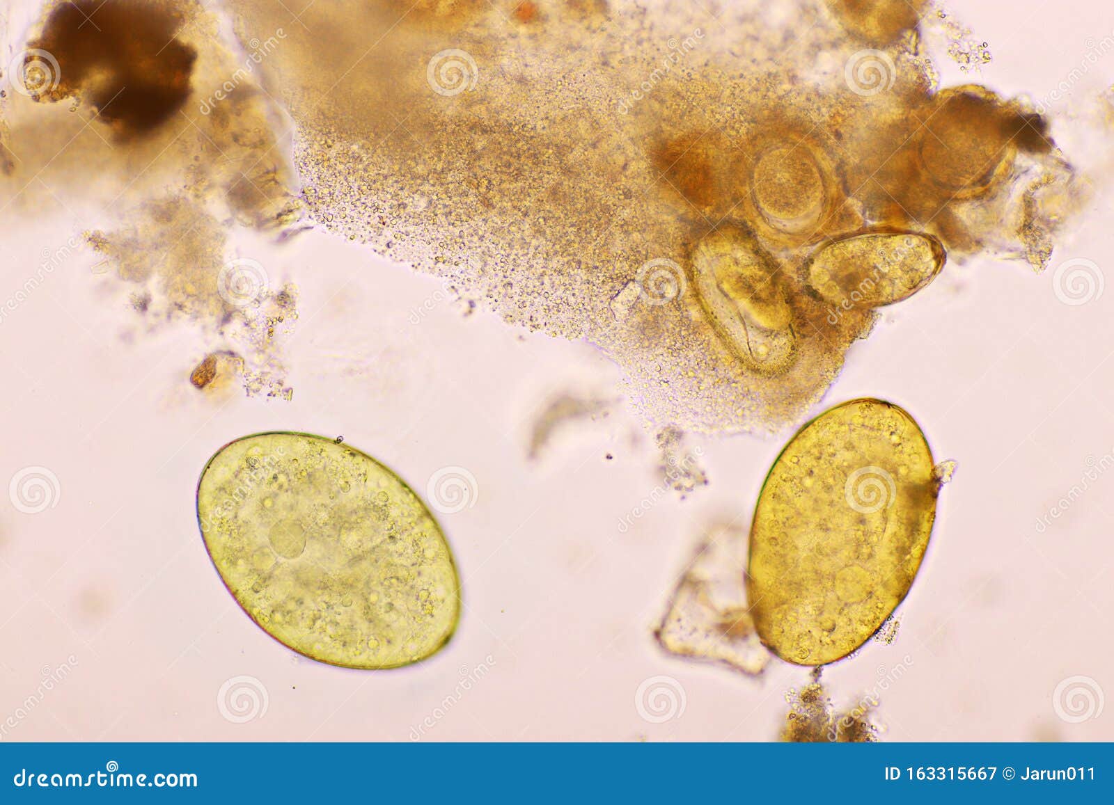 Eggs of Intestinal Fluke in Human Stool Stock Image - Image of