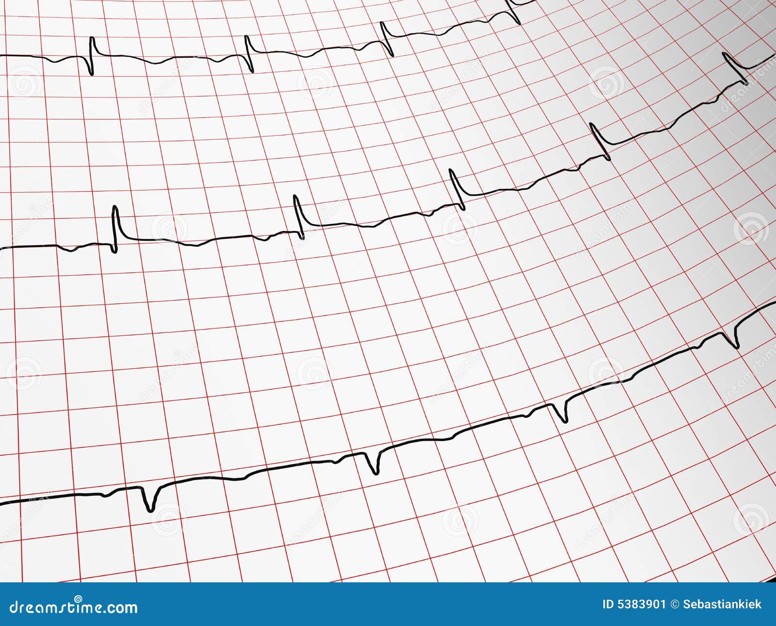 EKG Royalty-Free Stock Photography | CartoonDealer.com #5383901