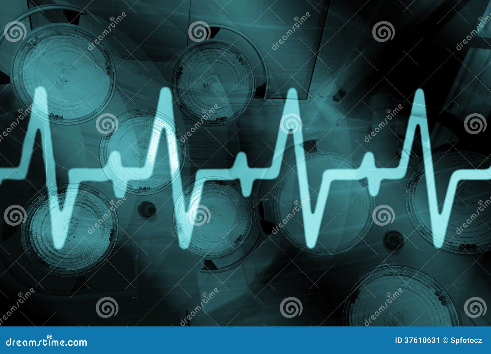 ekg signal