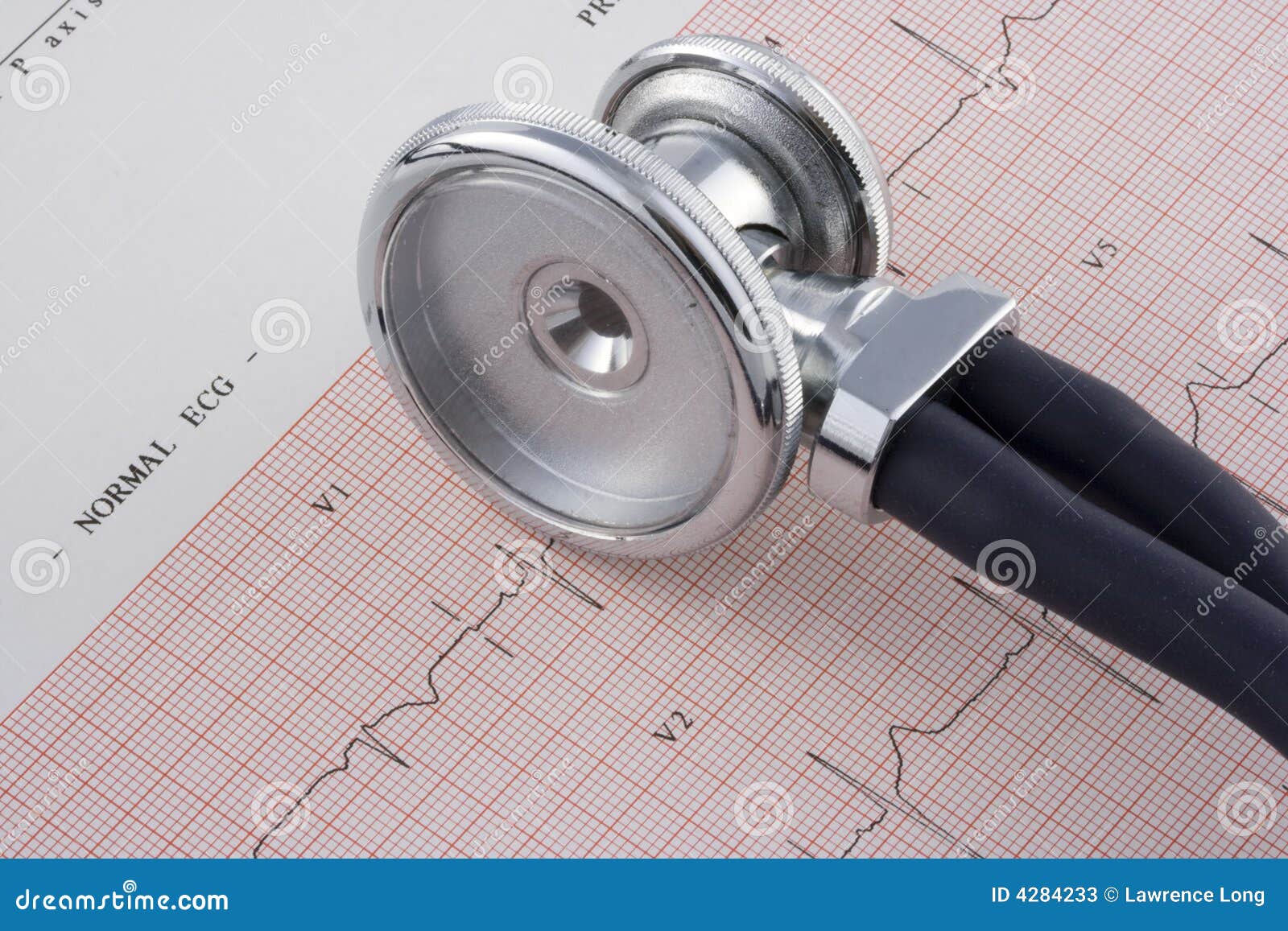 EKG And Stethoscope Picture. Image 4284233