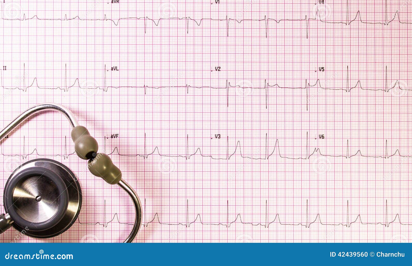 EKG with stethoscope stock photo. Image of illness, hospital 42439560
