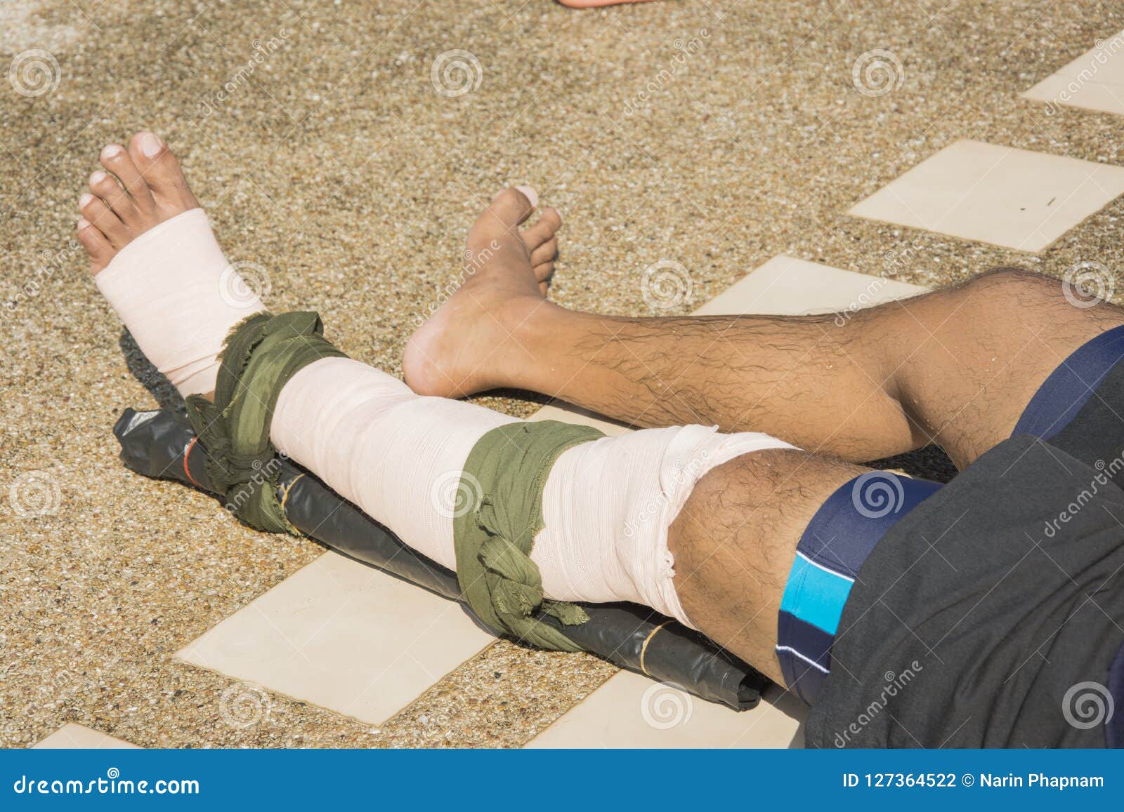 Elastic Bandage Apply Pressure Immobilized Technique or PIT Wind Stock