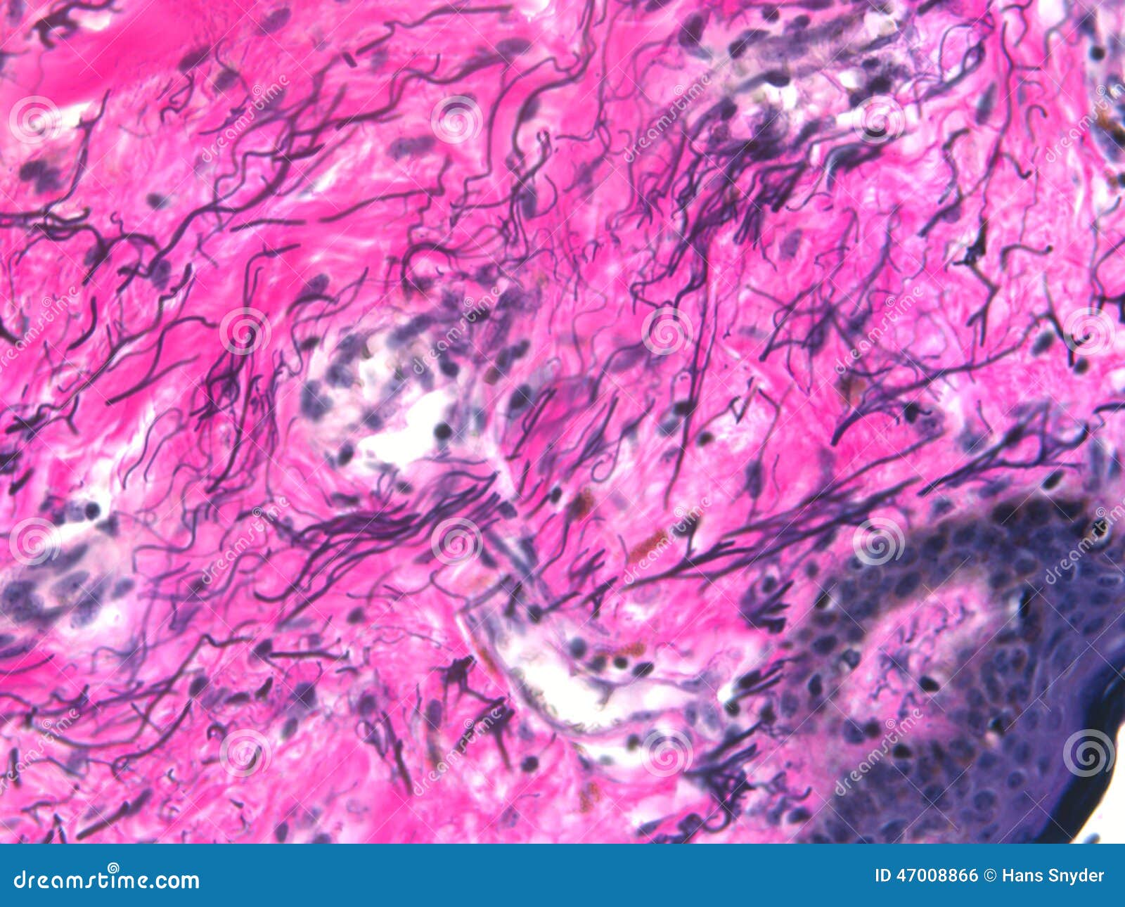 elastic fibers of the skin