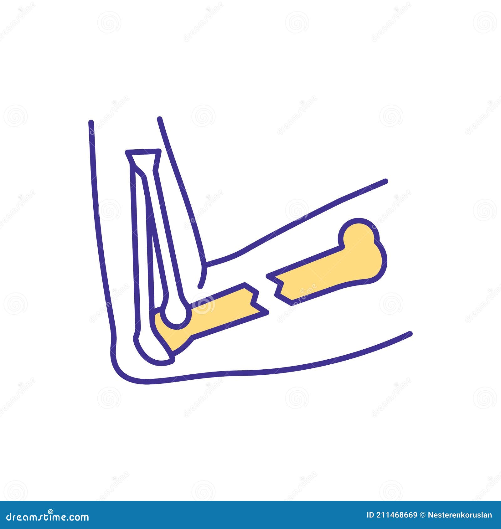 elbow fracture rgb color icon