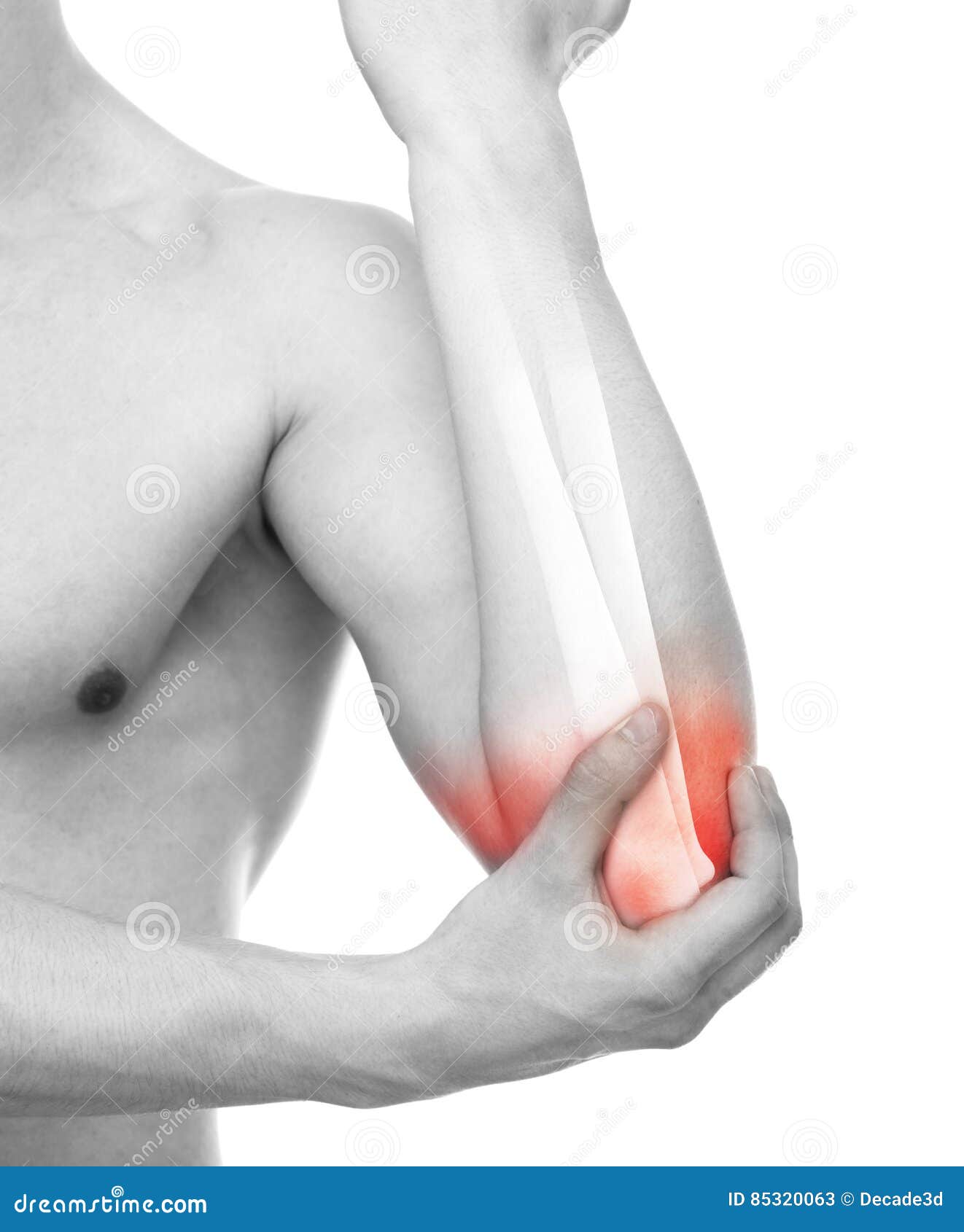 Elbow Injury Studio Shot with 3D Illustration Isolated on Whit Stock