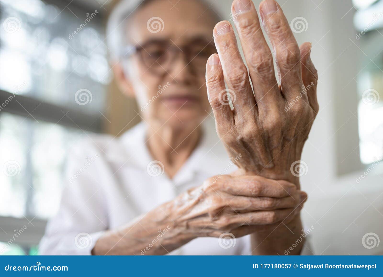 elderly female patient suffer from numbing pain in hand,numbness fingertip,arthritis inflammation,beriberi or peripheral