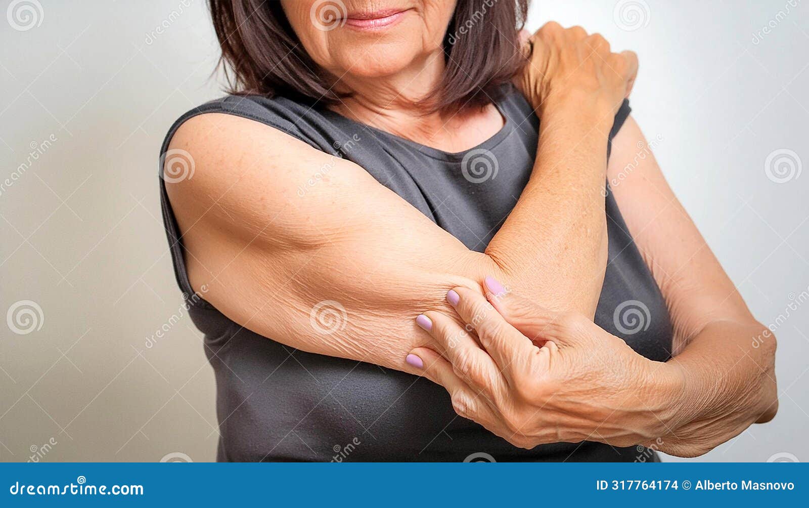 elderly lady showing loose skin or flab due to aging on her lower arm - generative ai