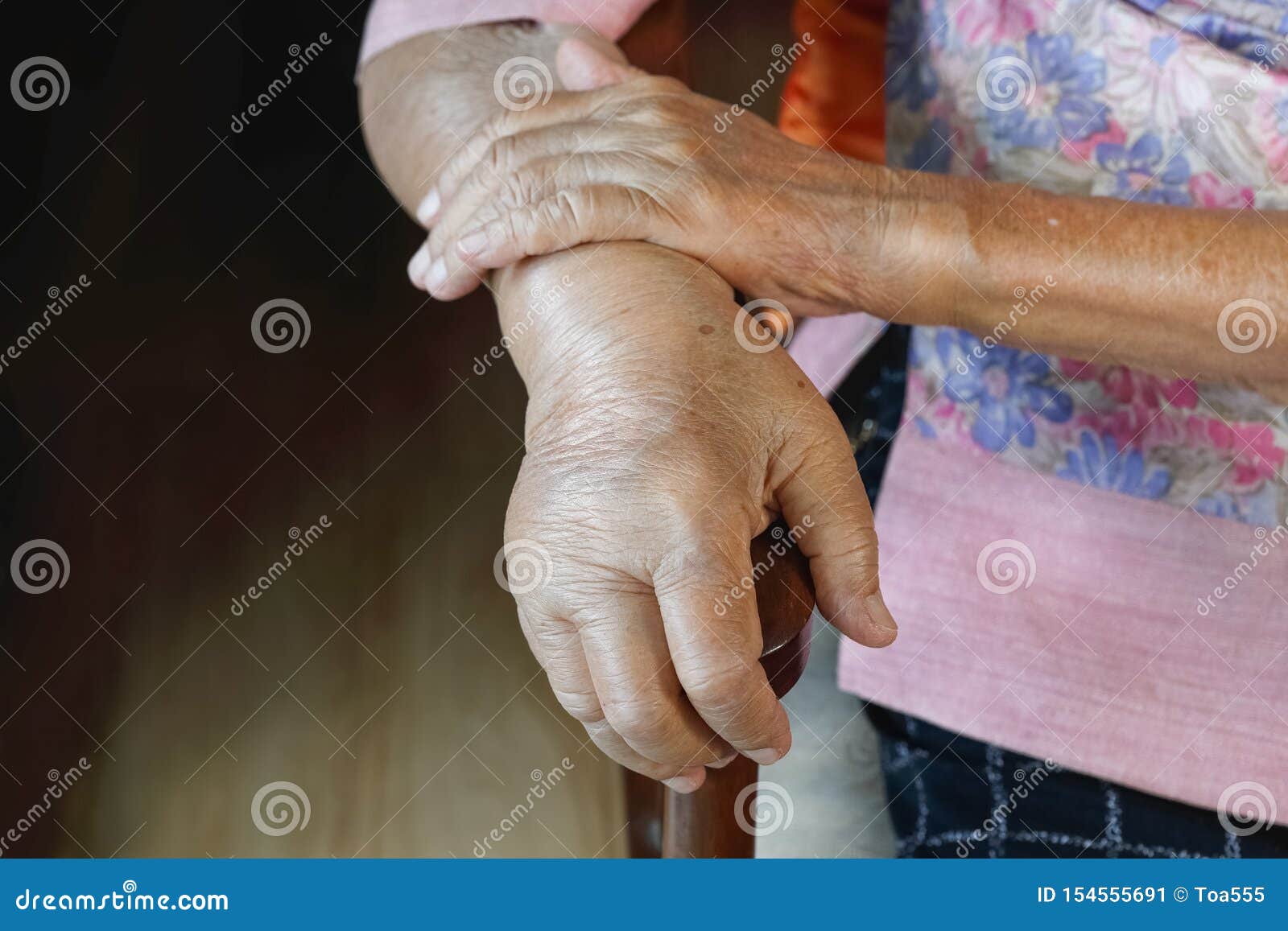 elderly swollen hand or edema hand