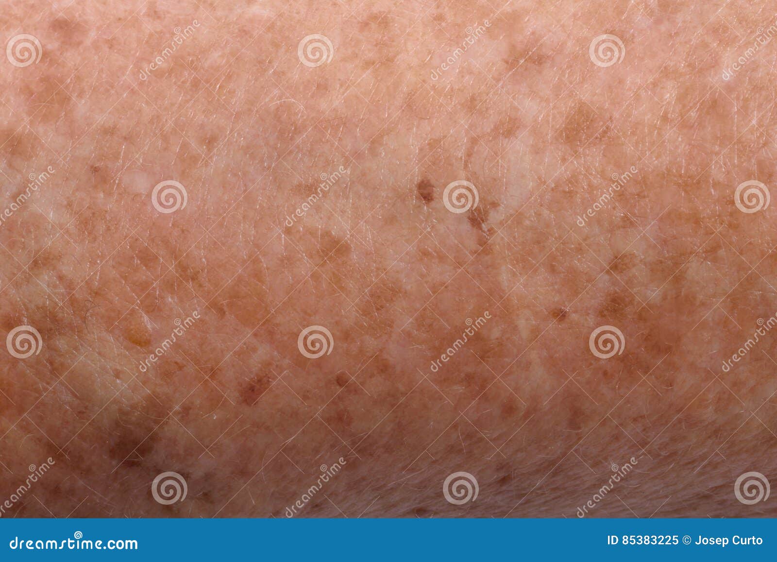 Elderly Woman Stock Image Image Of Skin Blemishes 85383225