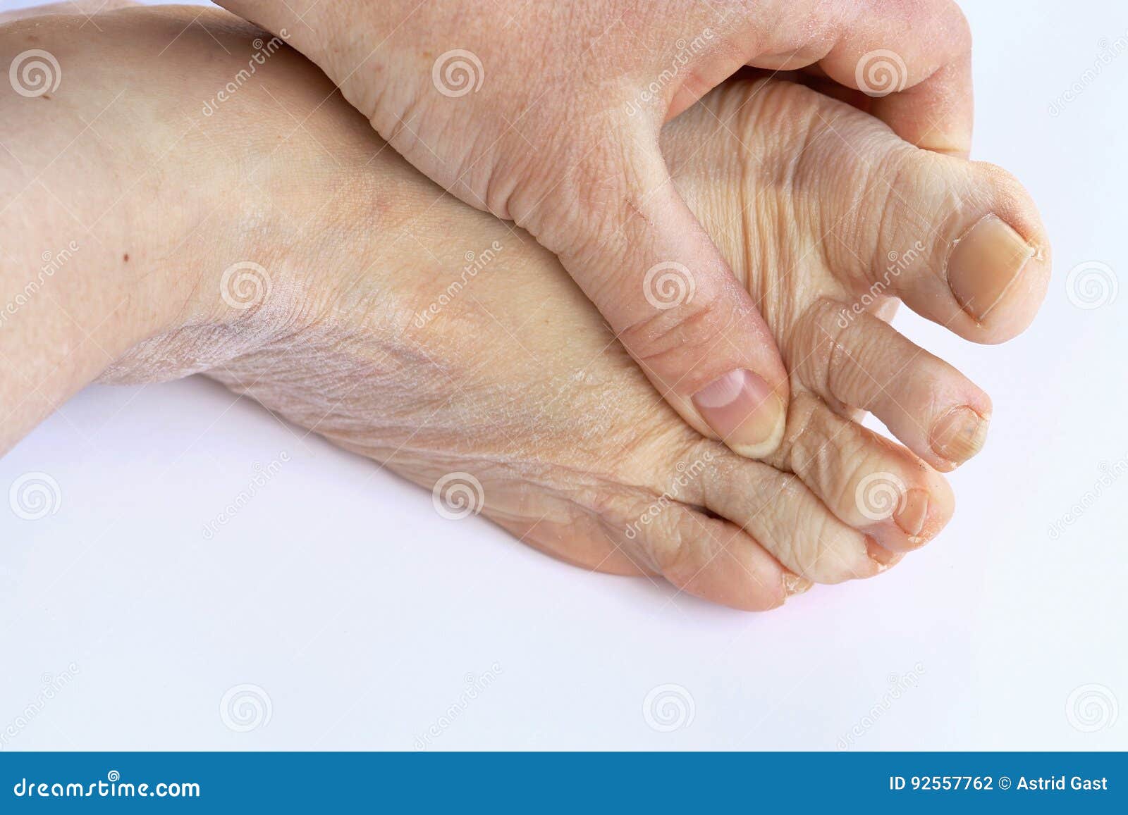 elderly woman has pain in the feet and toes