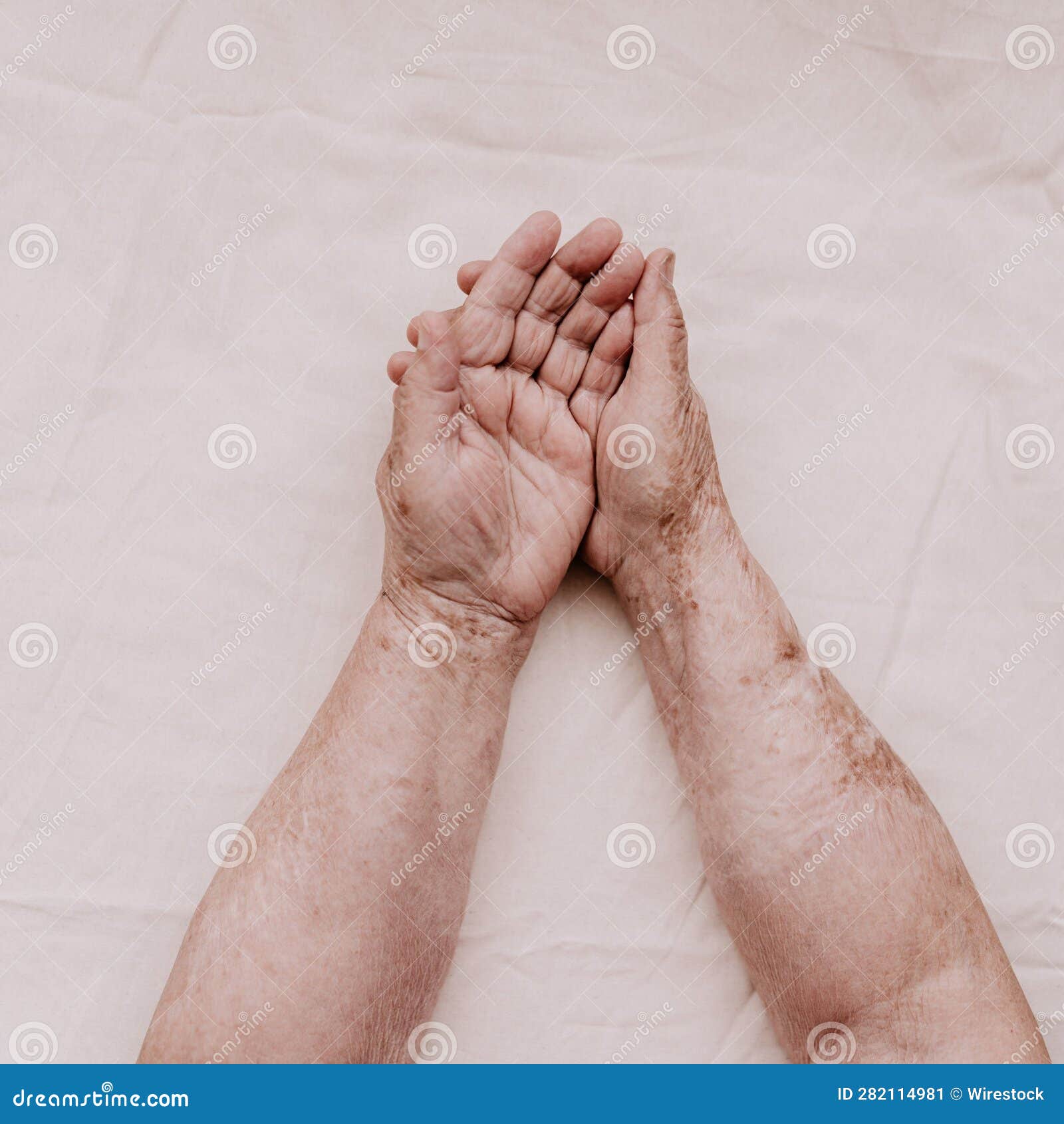 Elderly Woman S Hands are Seen Resting on a White Surface, Her Wrinkled and Aged Skin in Full View Stock Image photo